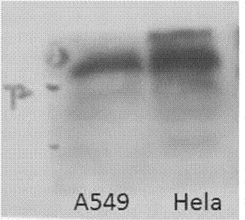 AEG-1 (Astrocyte Elevated Gene-1)/1E3 monoclonal antibody with high affinity