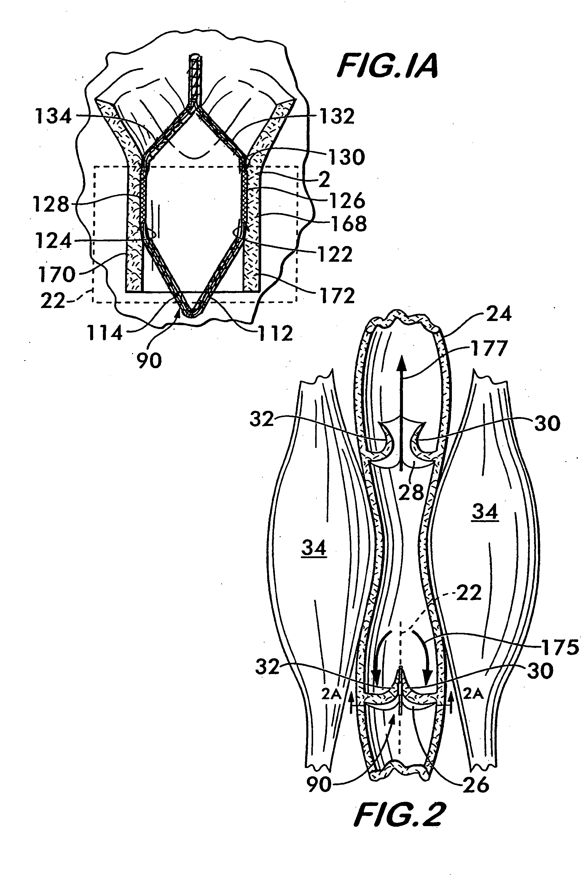 Tissue distention device and related methods for therapeutic intervention