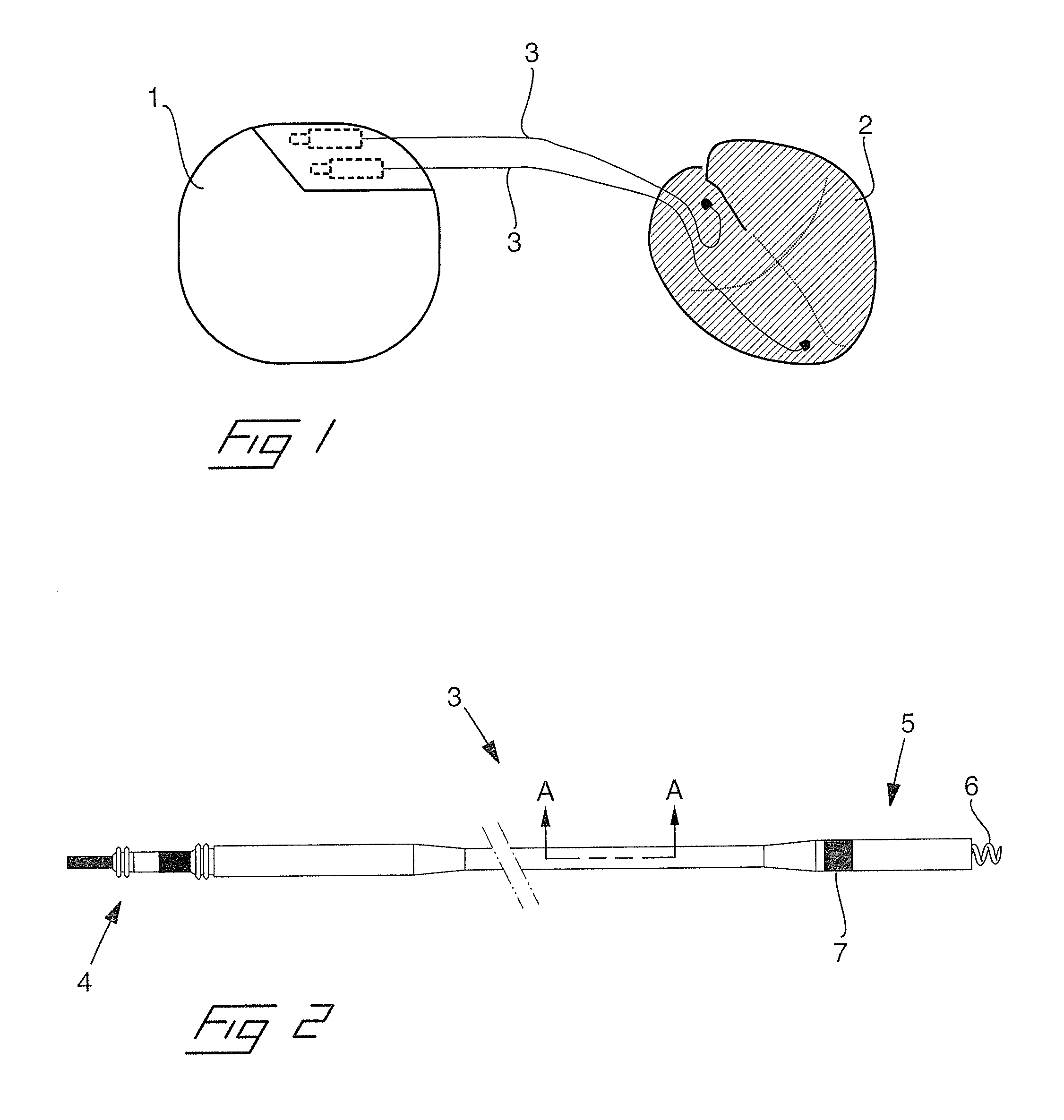 Medical implantable lead and method for the manufacture thereof