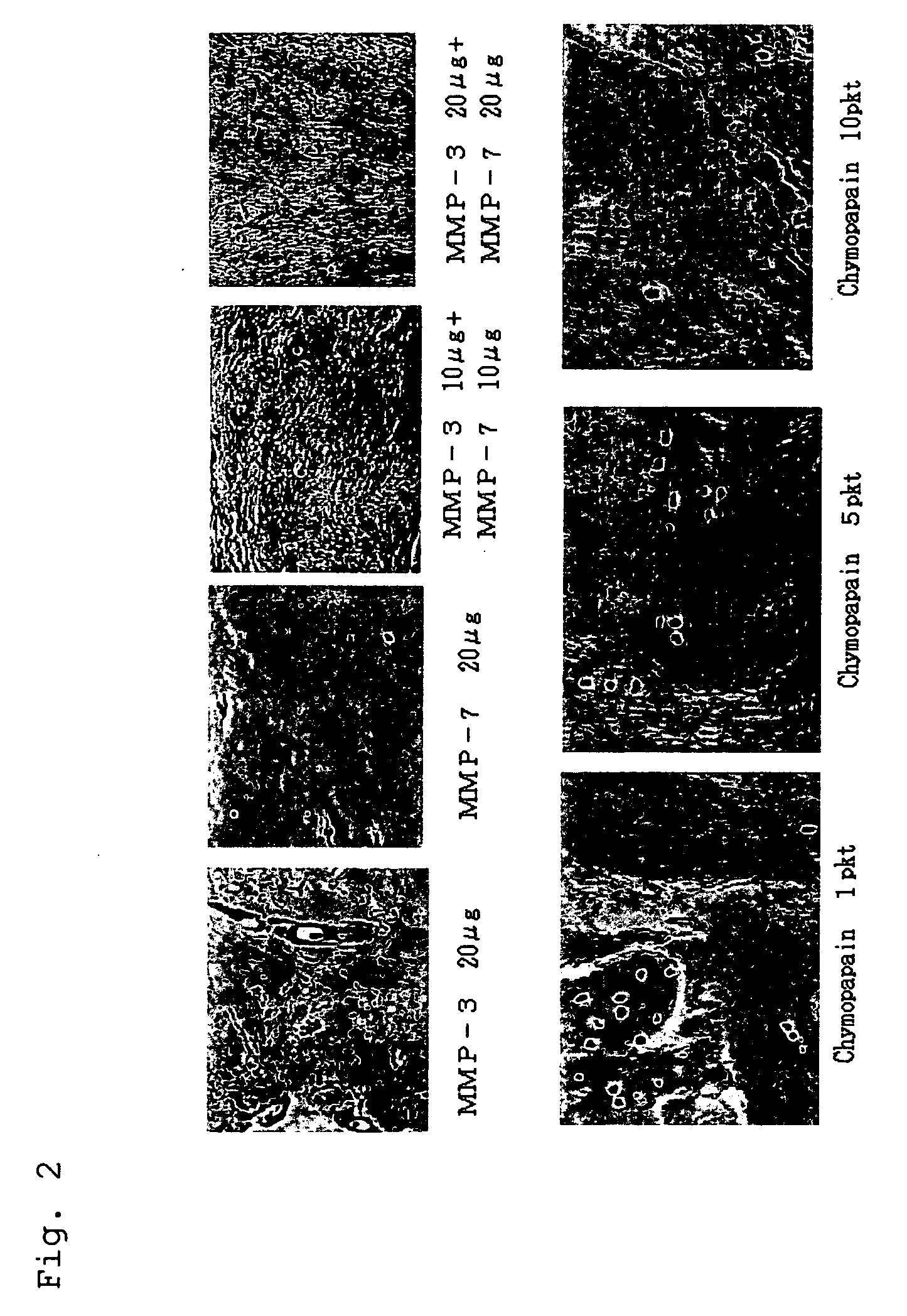 Remedy for degenerative intervertebral discs