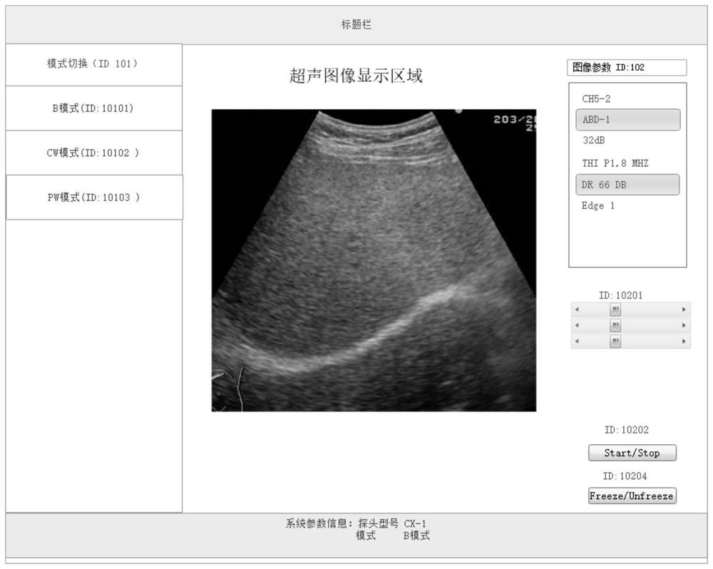 Interface optimization method and medical device