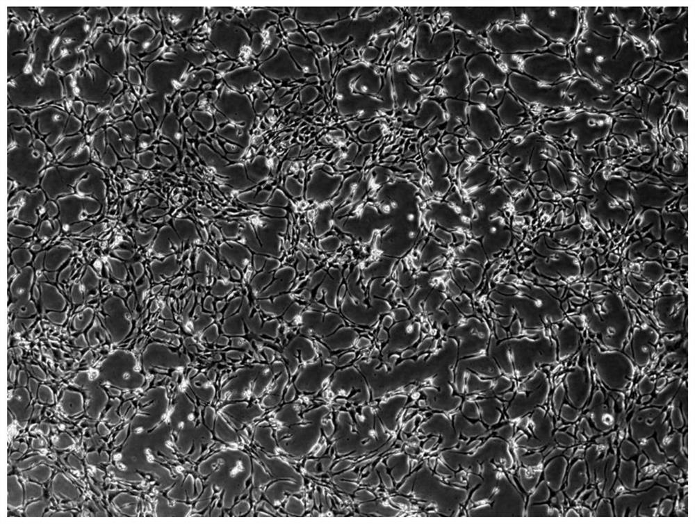 Method for preparing immortalized posterior longitudinal ligament cells of patient with posterior longitudinal ligament ossification