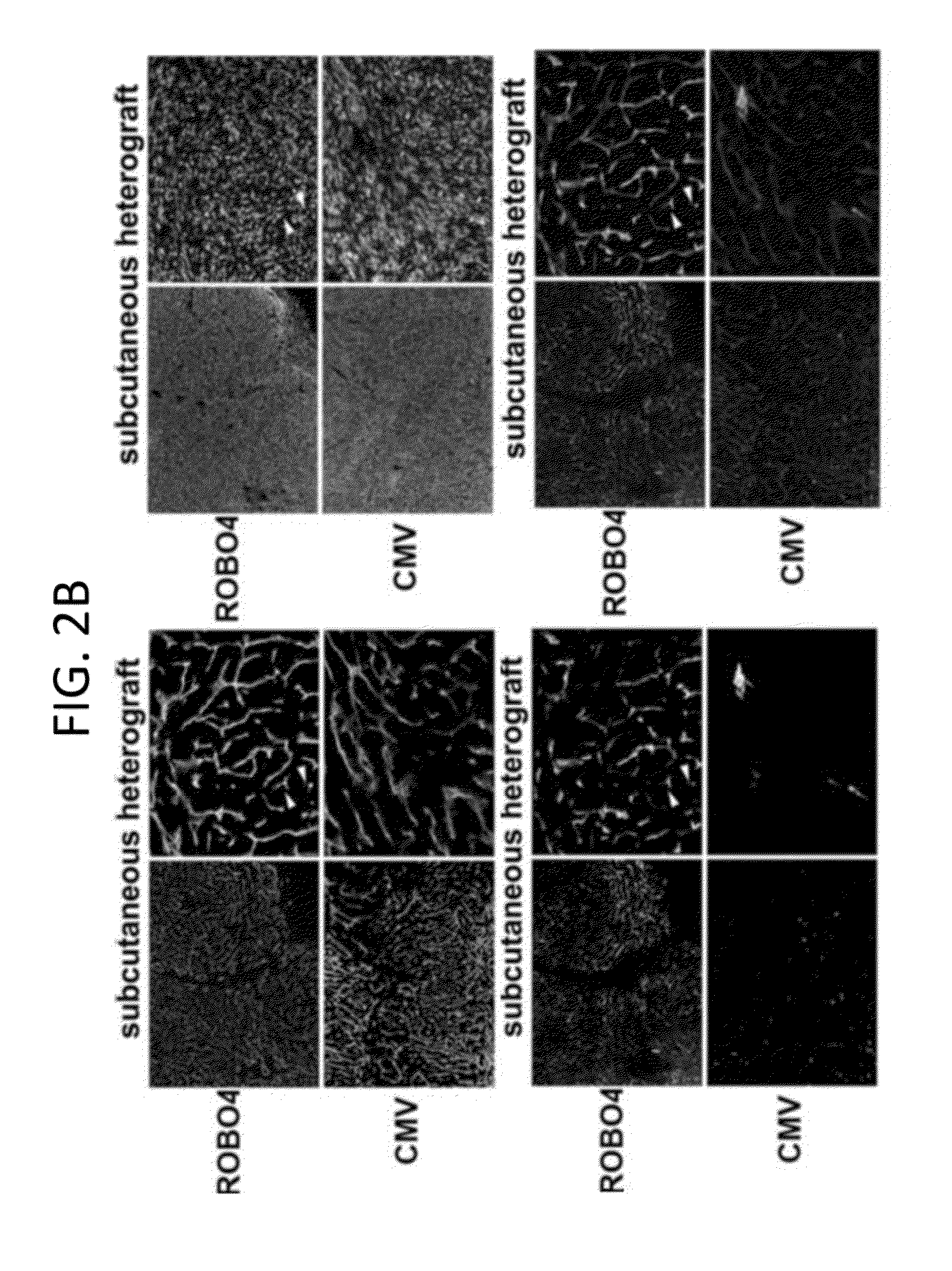 Endothelial-targeted Adenoviral Vectors, Methods and Uses Therefor