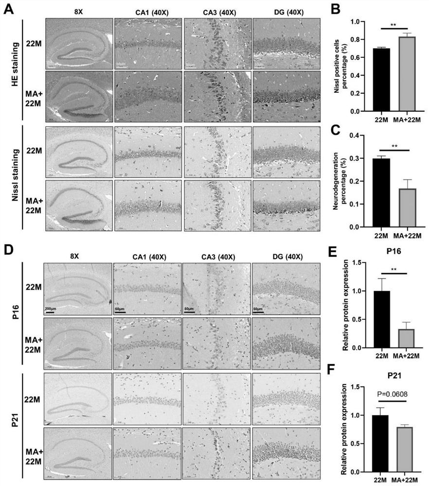 Application of myristic acid in preparation of brain aging resisting medicine