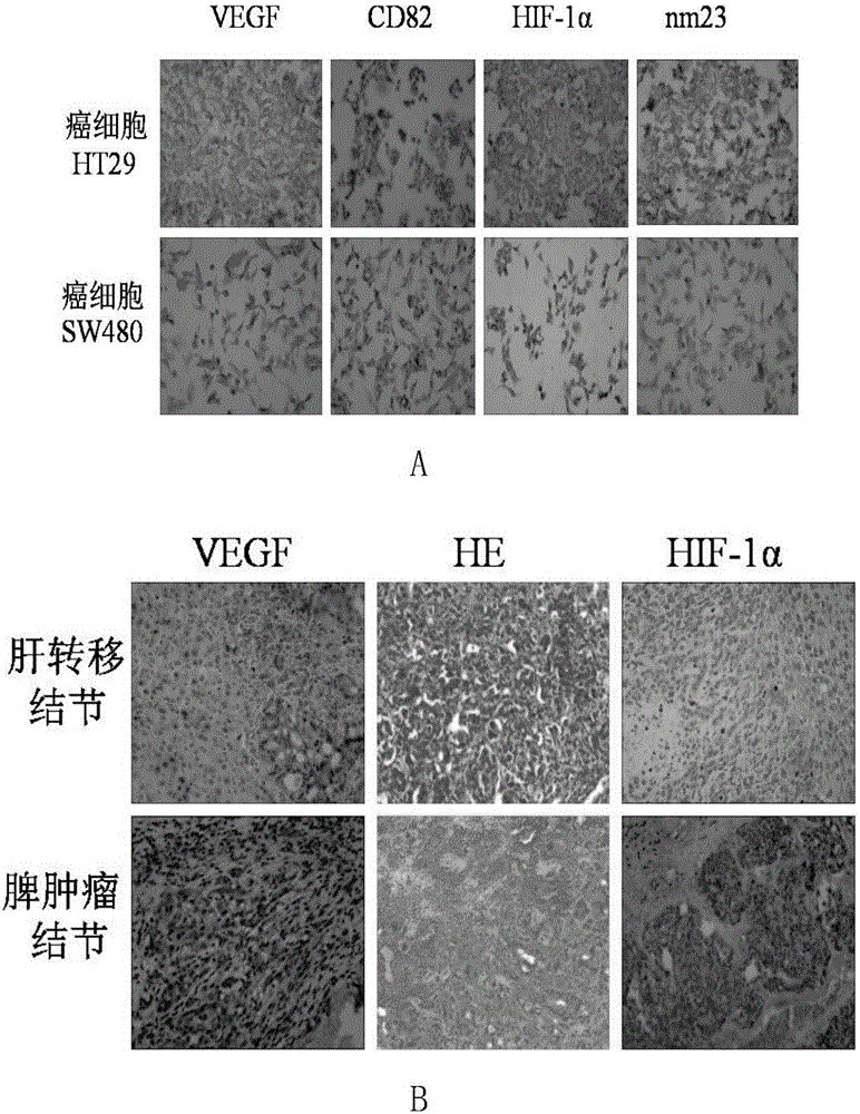 Colorectal cancer early hepatic metastasis animal model and construction method and application thereof