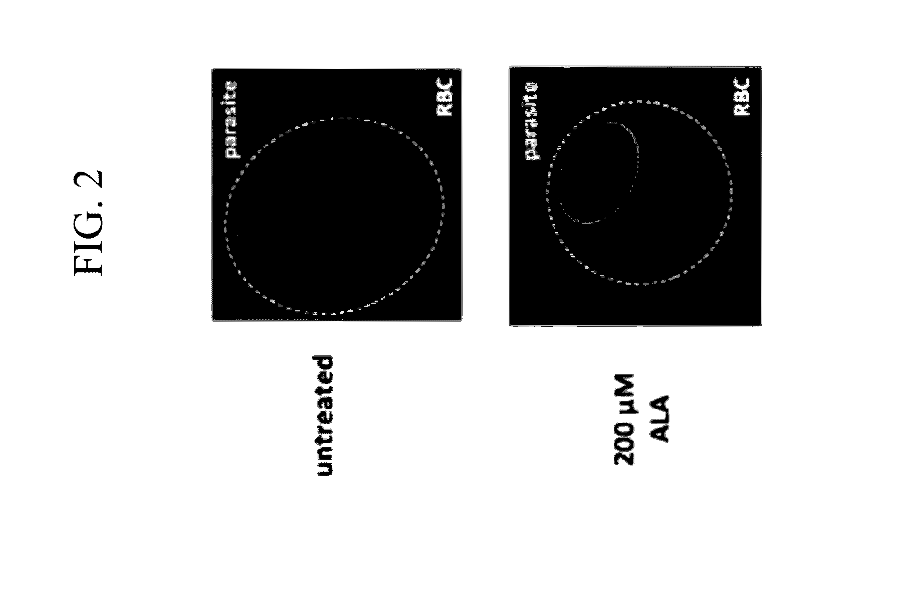 Combination artemisinin and chemiluminescent photodynamic therapy and uses therefor