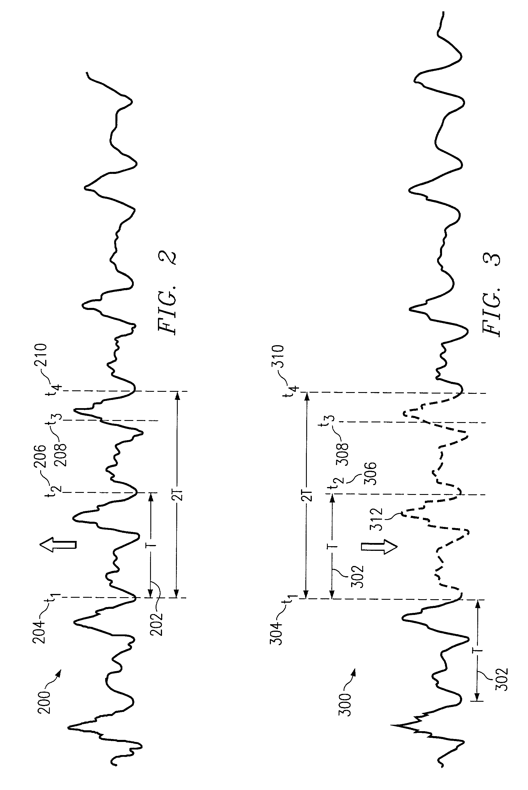 Method and apparatus for concealing jitter buffer expansion and contraction