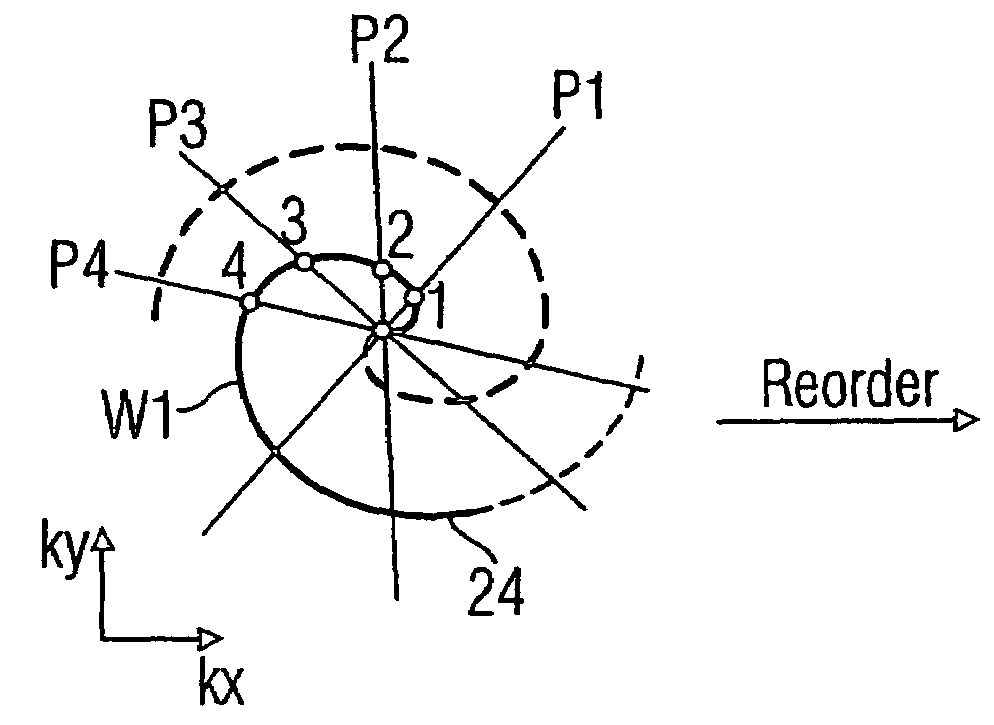 Magnetic resonance imaging method using a partial parallel acquisition technique with non-Cartesian occupation of k-space