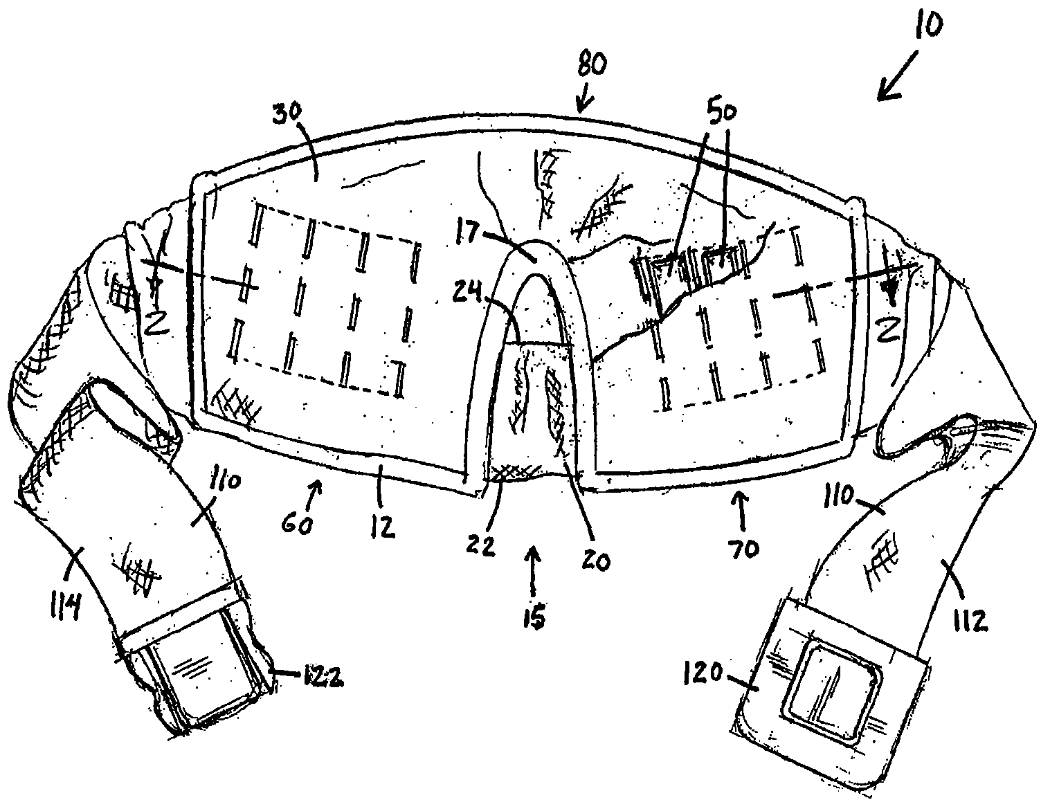 Site-specific pad with notch