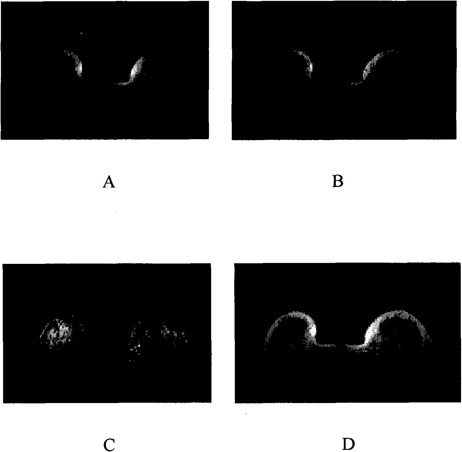 Tissue separation imaging method based on inversion recovery