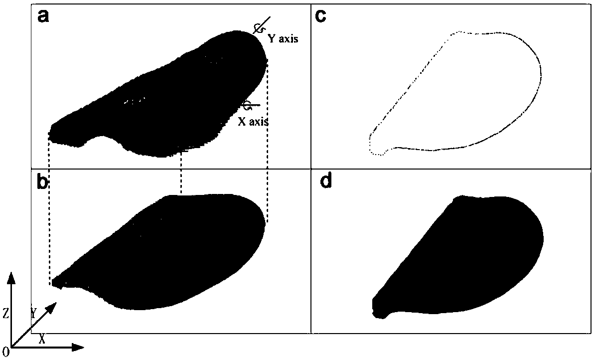 Auricle defect measurement method based on optical three-dimensional measurement