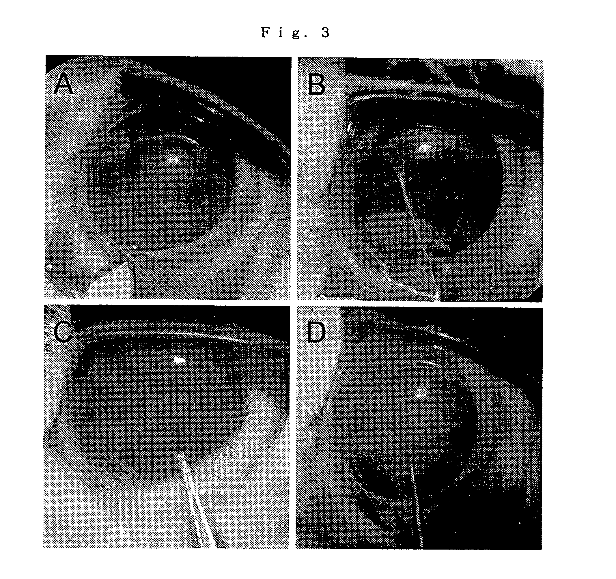 Laminate of cultured human corneal endothelial cells layer and method for manufacturing same