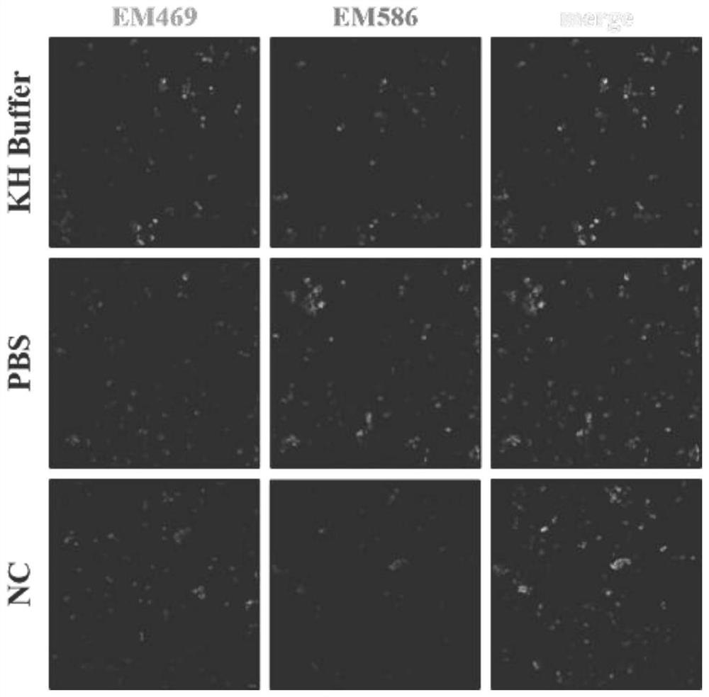 Application of UMI-77 as mitochondrial autophagy inducer to preparation of medicine for treating inflammation and neurodegenerative diseases