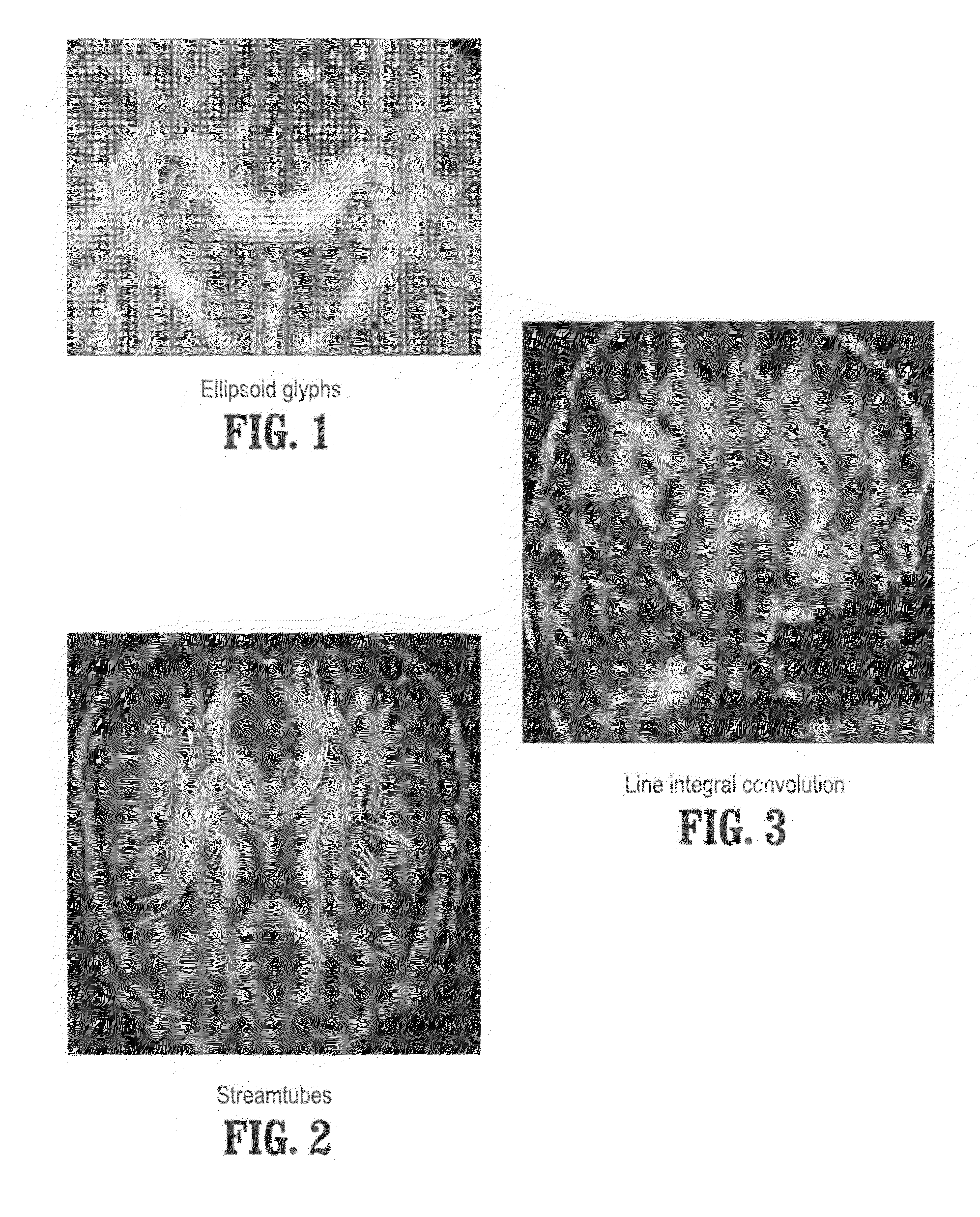 System and method for stochastic DT-MRI connectivity mapping on the GPU