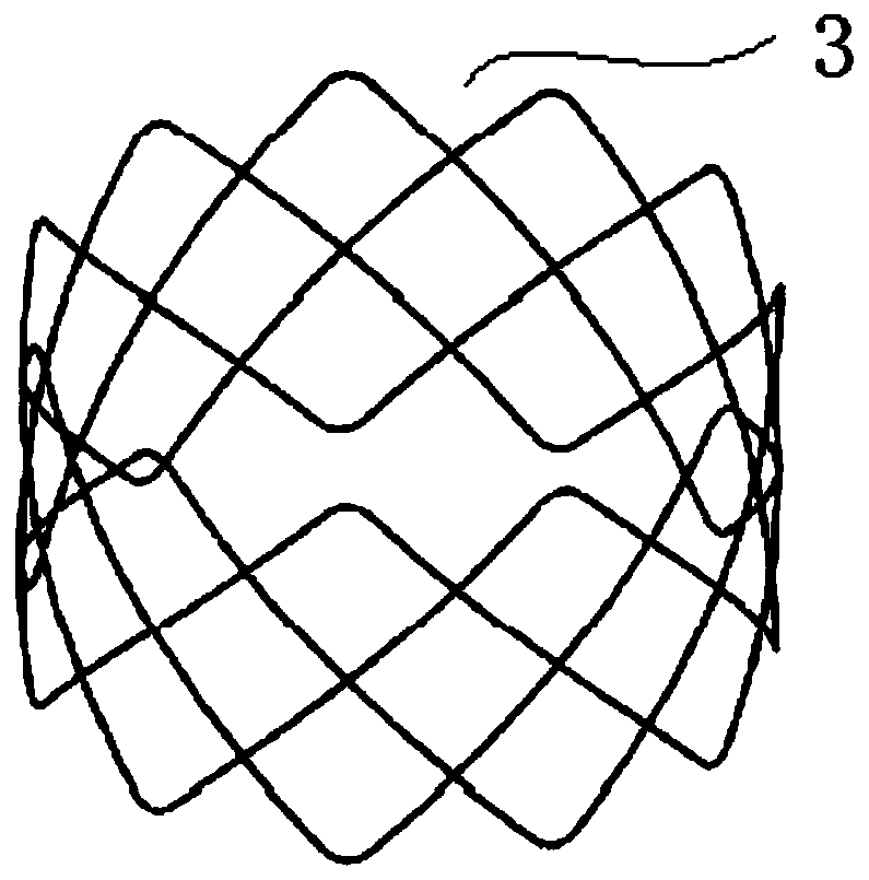 Nasal sinus stent