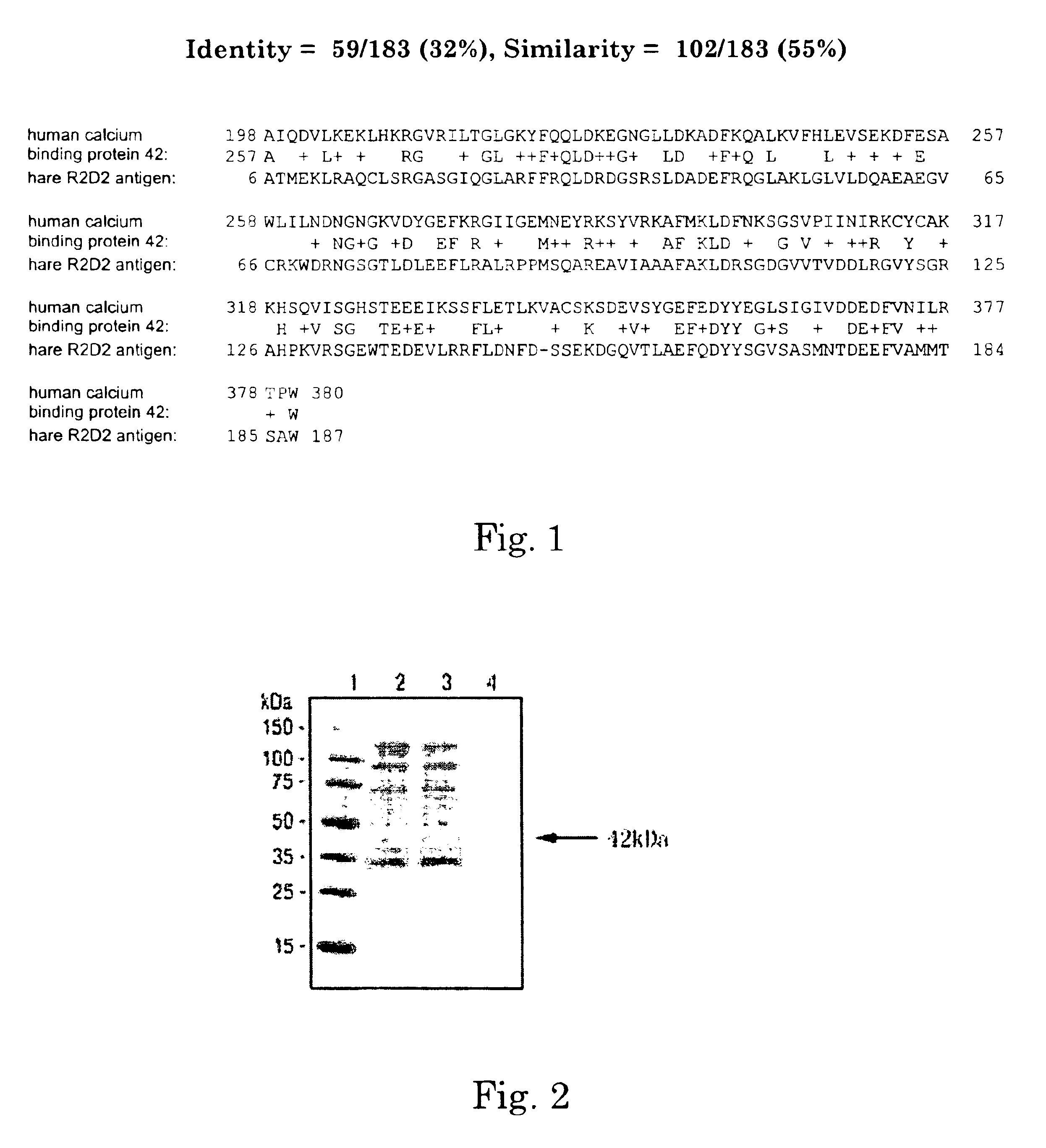 Human calcium binding protein and a polynucleotide encoding the same