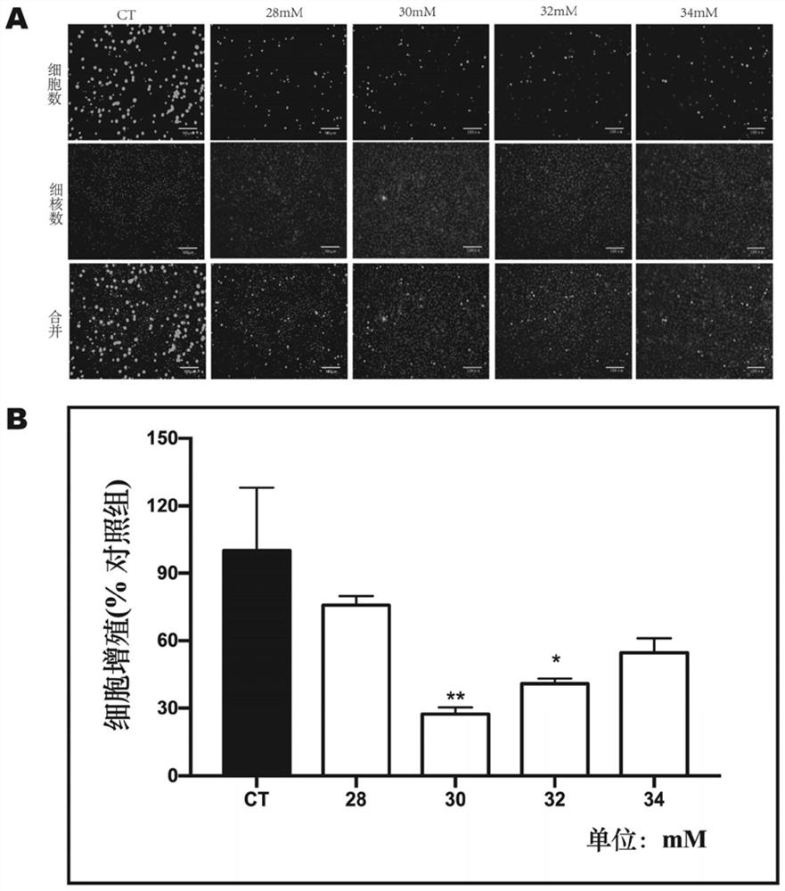 Porcine epithelial cell oxidative stress model, establishment method therefor and application of porcine epithelial cell oxidative stress model