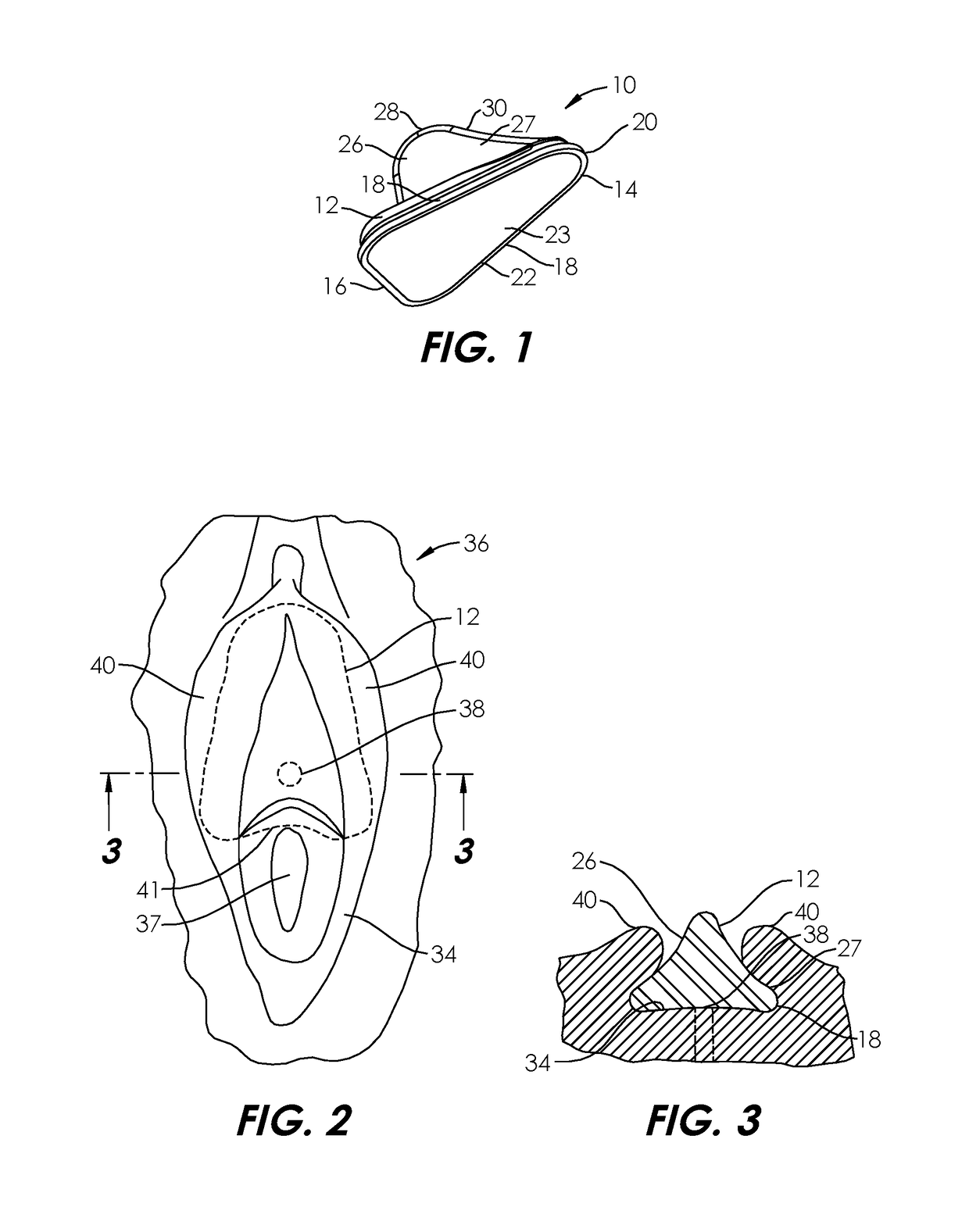 Systems and methods for incontinence control