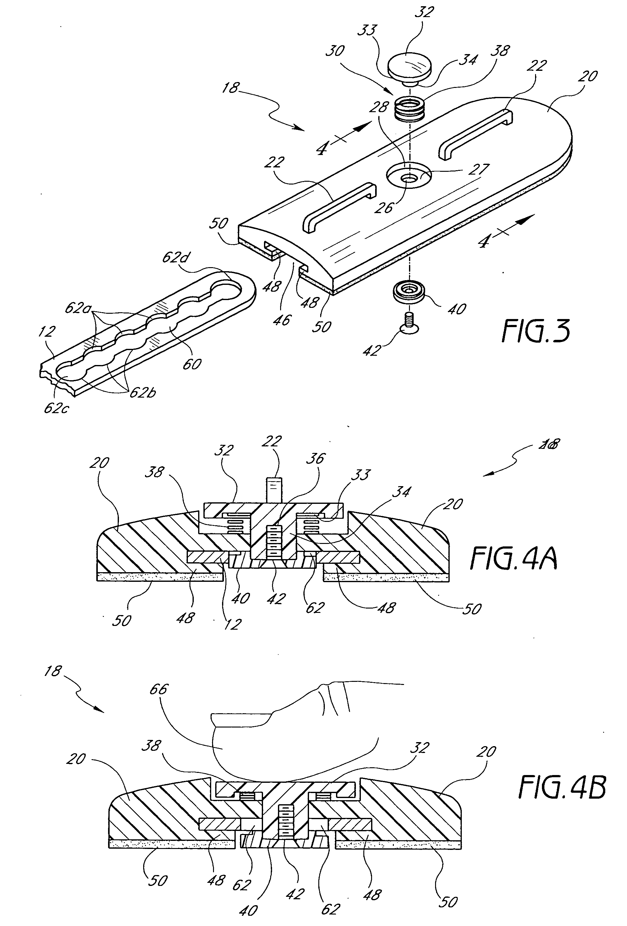 Orthopaedic brace having a range of motion hinge with an adjustable-length strut