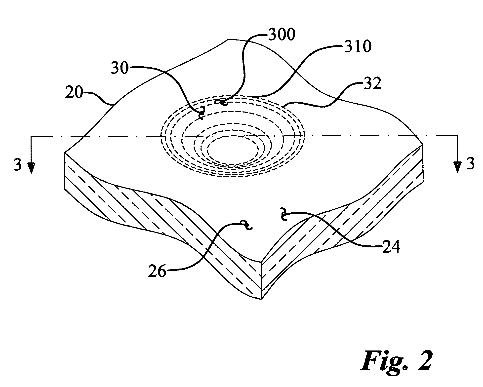 System and method for electromagnetic pulse surface treatment