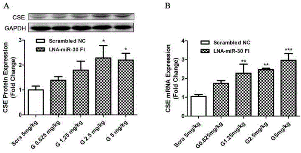 Application of miR-30 family inhibitor in preparation of medicament for preventing and treating acute myocardial infarction