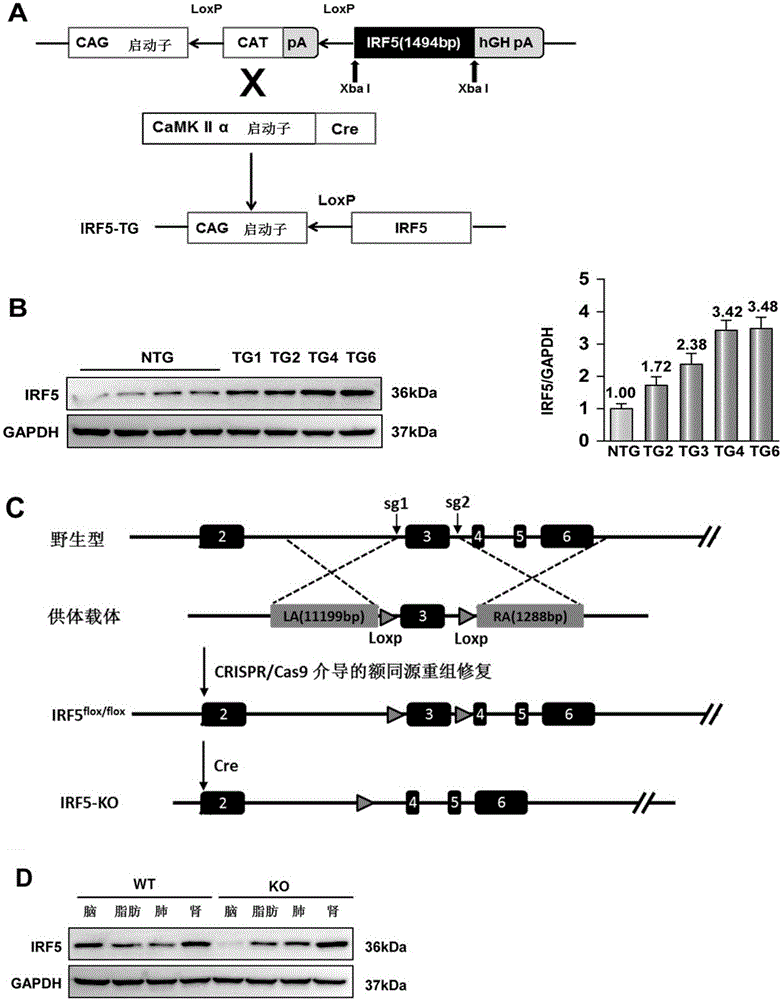 Application of interferon regulatory factor 5 and inhibitor thereof to cerebral stroke diseases