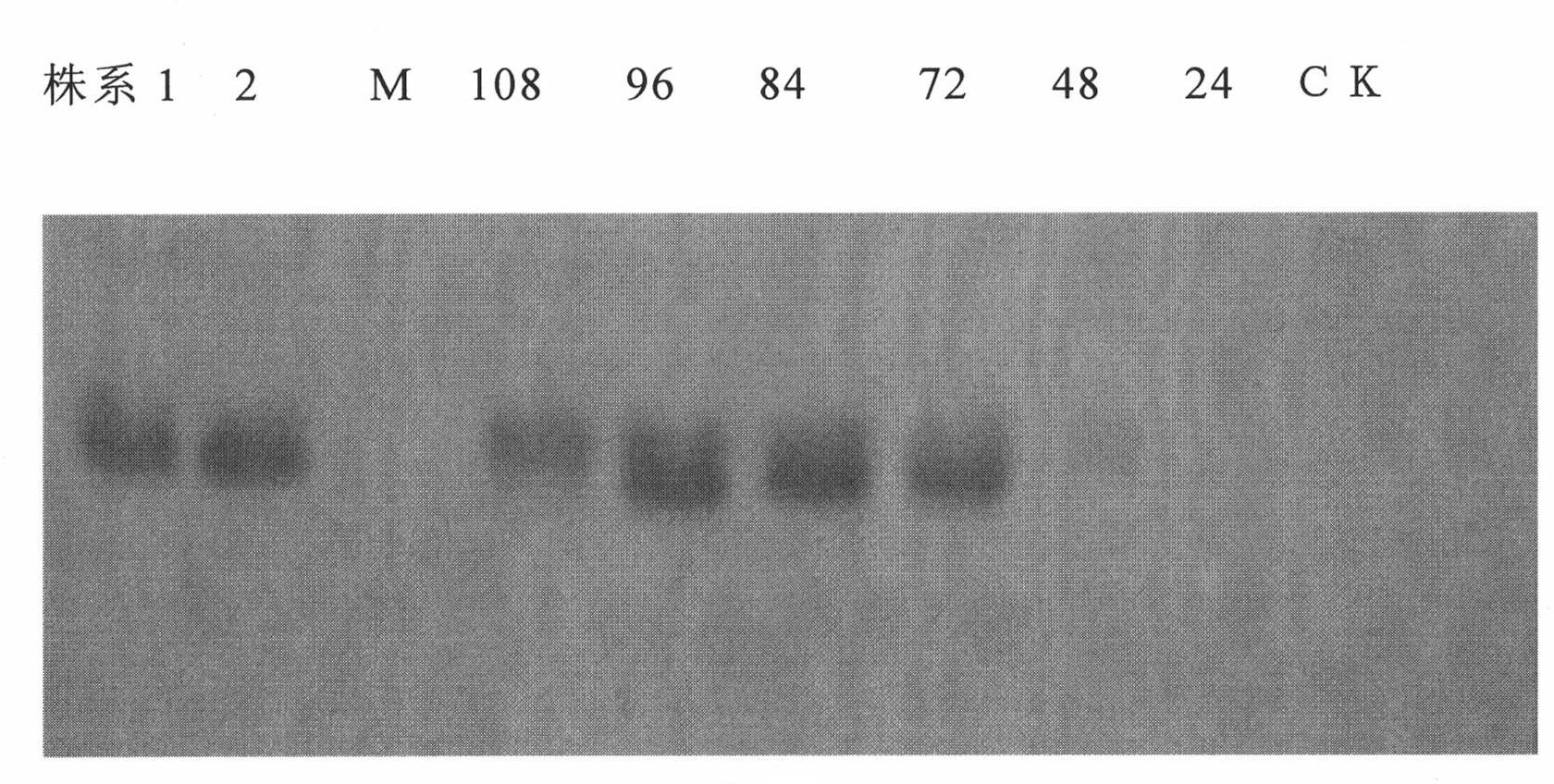 Hydatidovis soluble antigen preparation method and product thereof