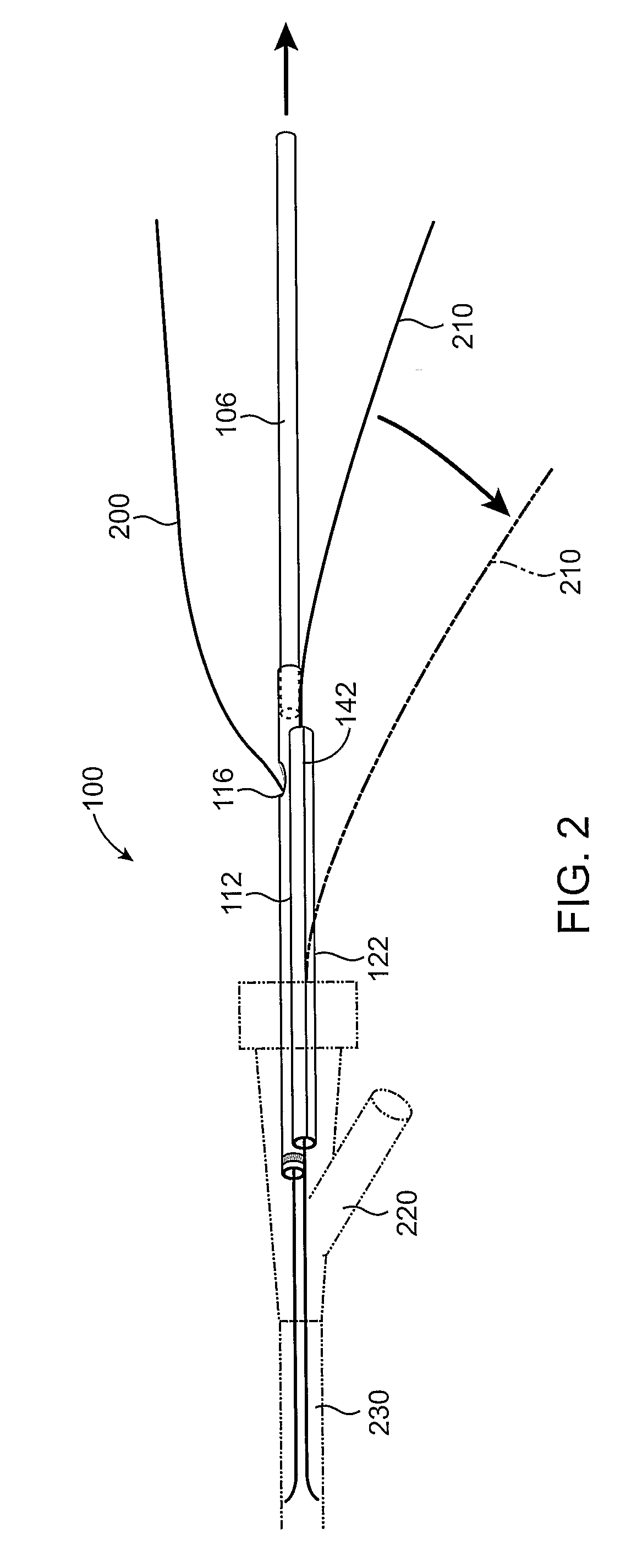 Guidewire Separator Device and Method of Use