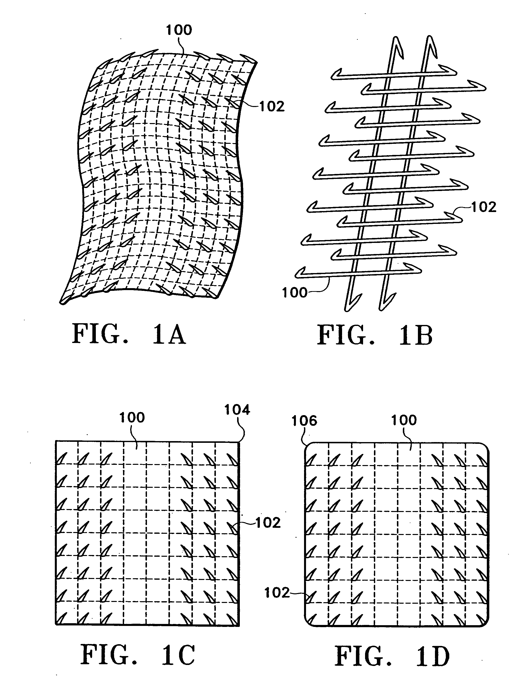 Remotely anchored tissue fixation device and method