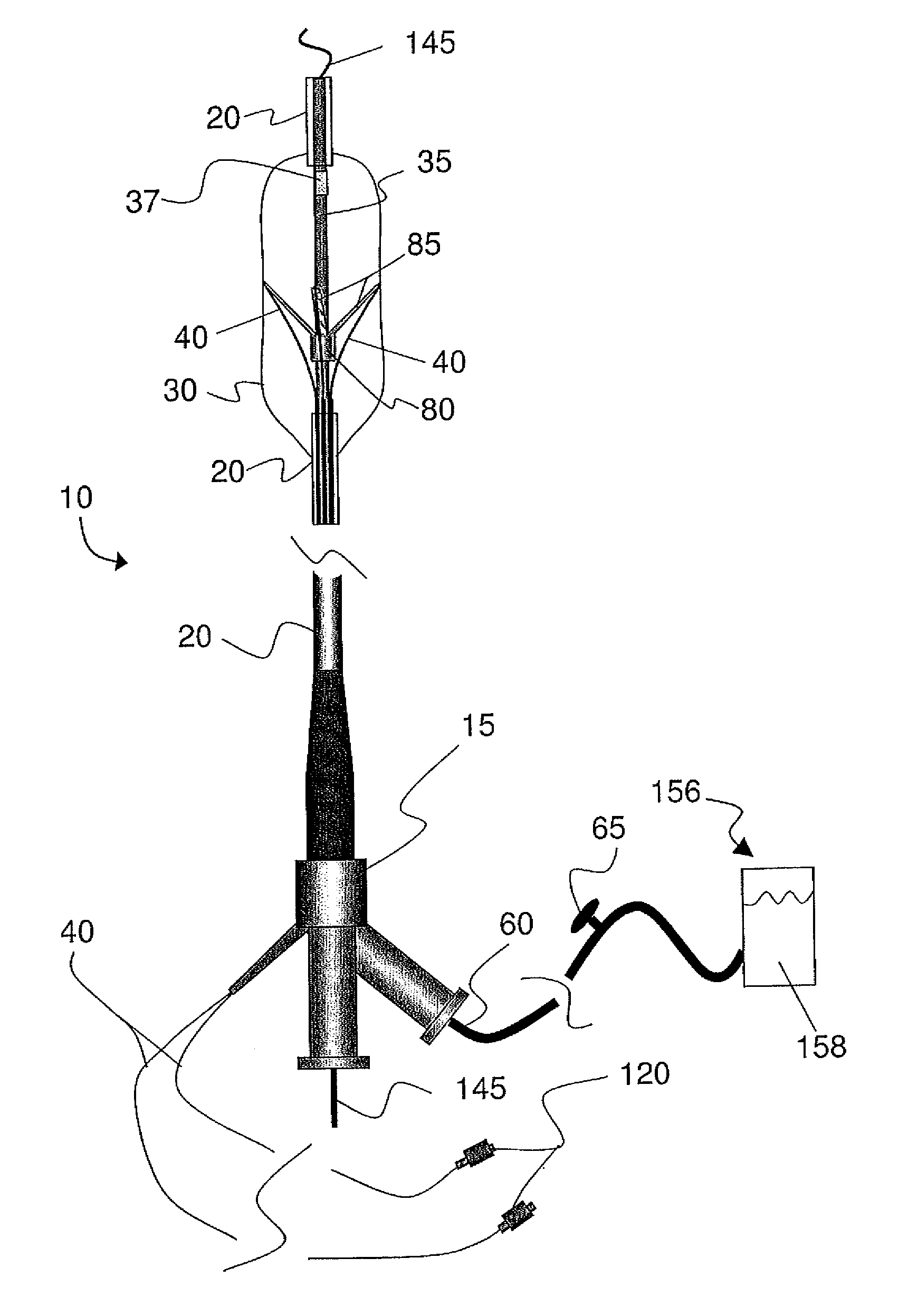 Systems and methods for analysis and treatment of a body lumen