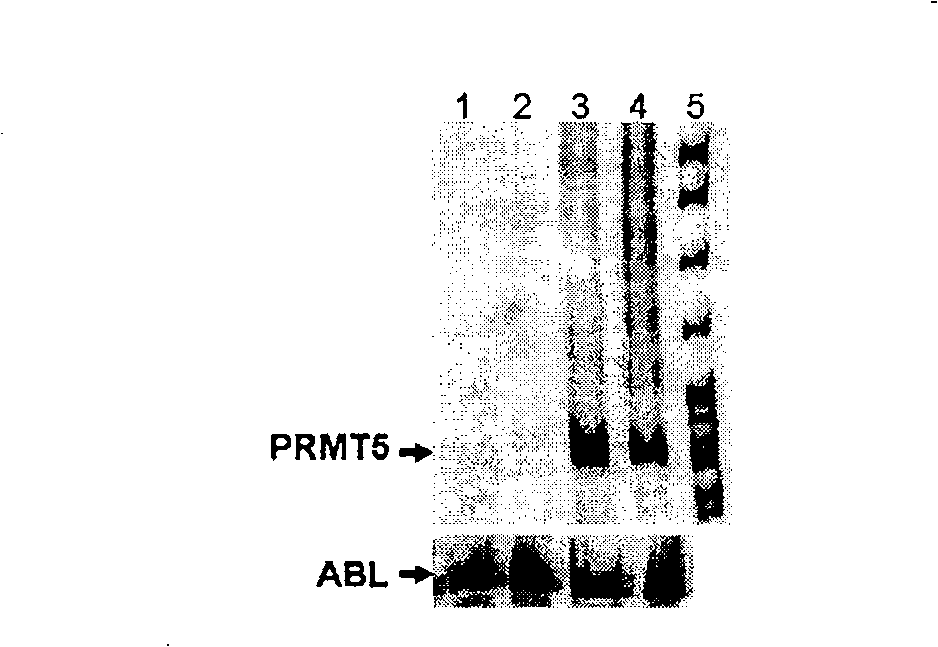 Application of protein arginine methyl transferase 5 in cell detection and treatment of leukemia
