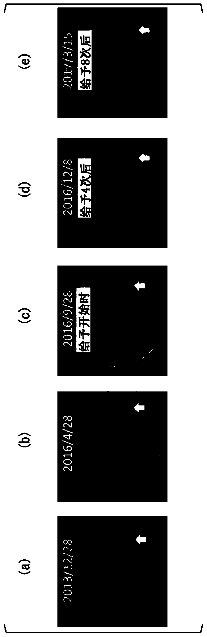 Peptide vaccine and peptide vaccine composition for cranial nerve disease