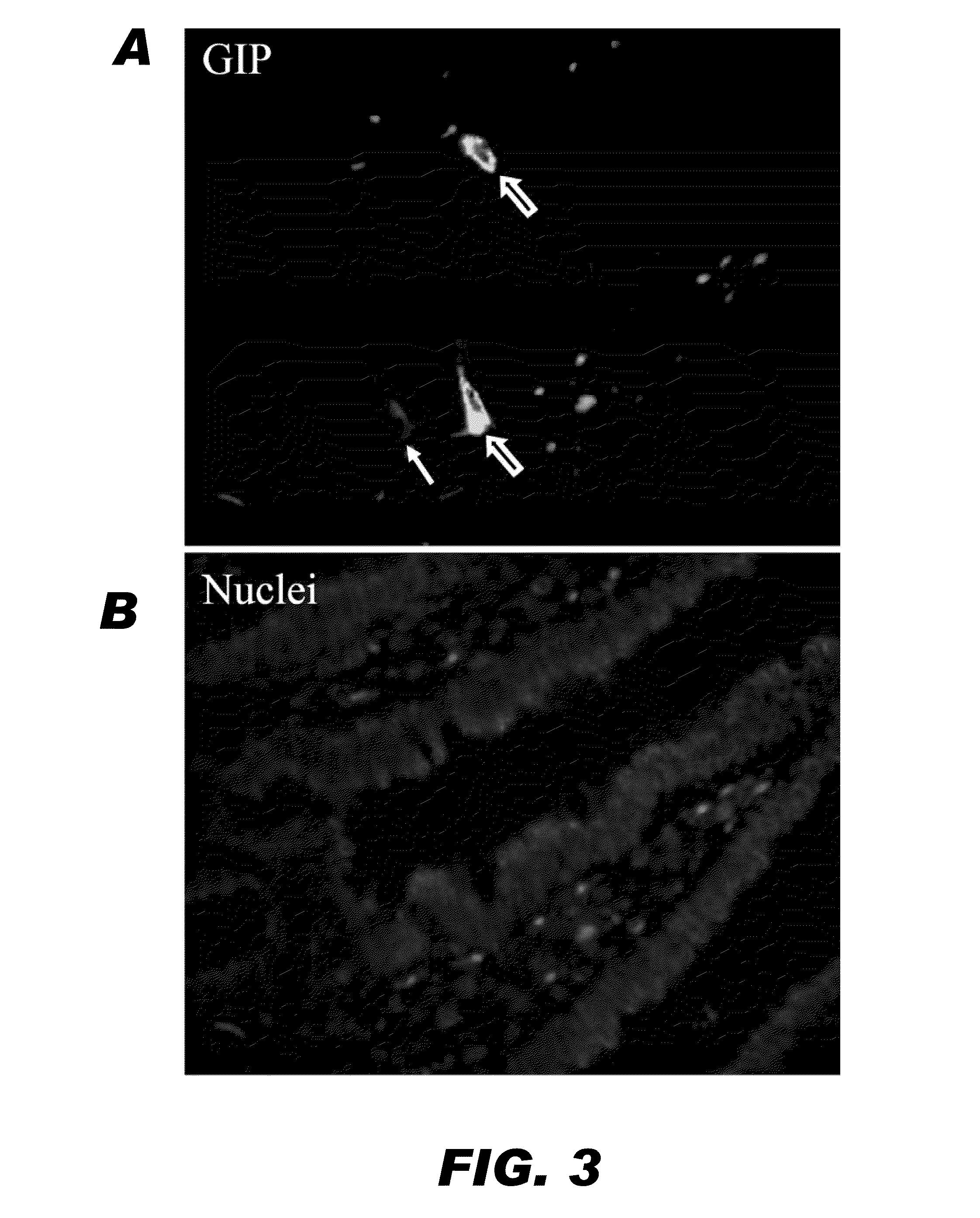 Methods and compositions for modulating insulin regulation