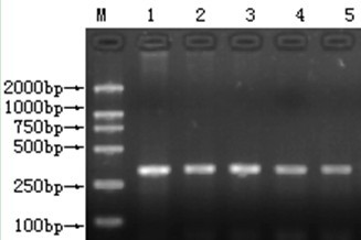 Method for detecting mutation polymorphism of 5 basic groups in gene coding region of goat growth hormone