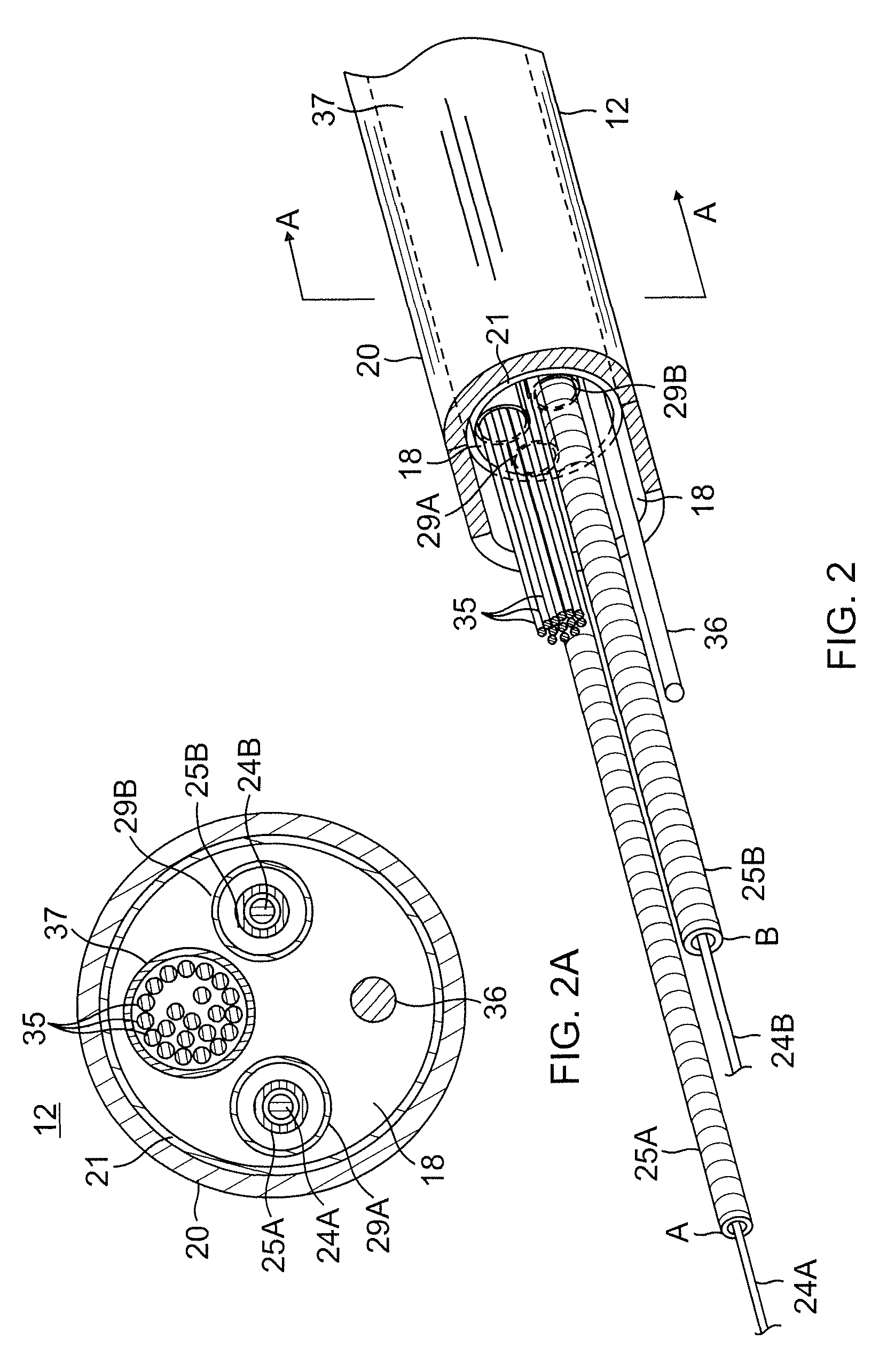 Double loop lasso with single puller wire for bi-directional actuation