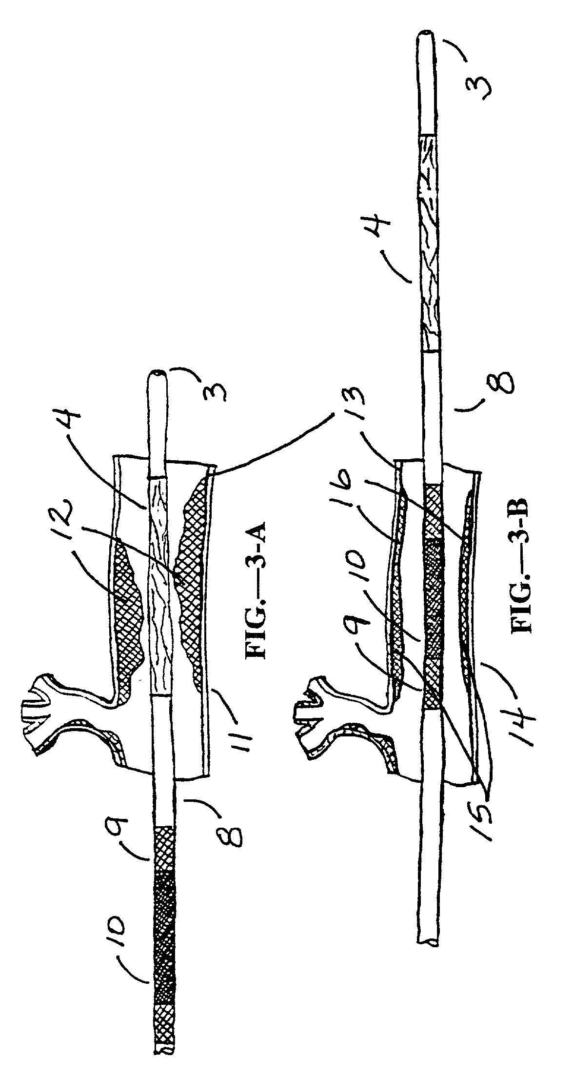 Dilating and support apparatus with disease inhibitors and methods for use