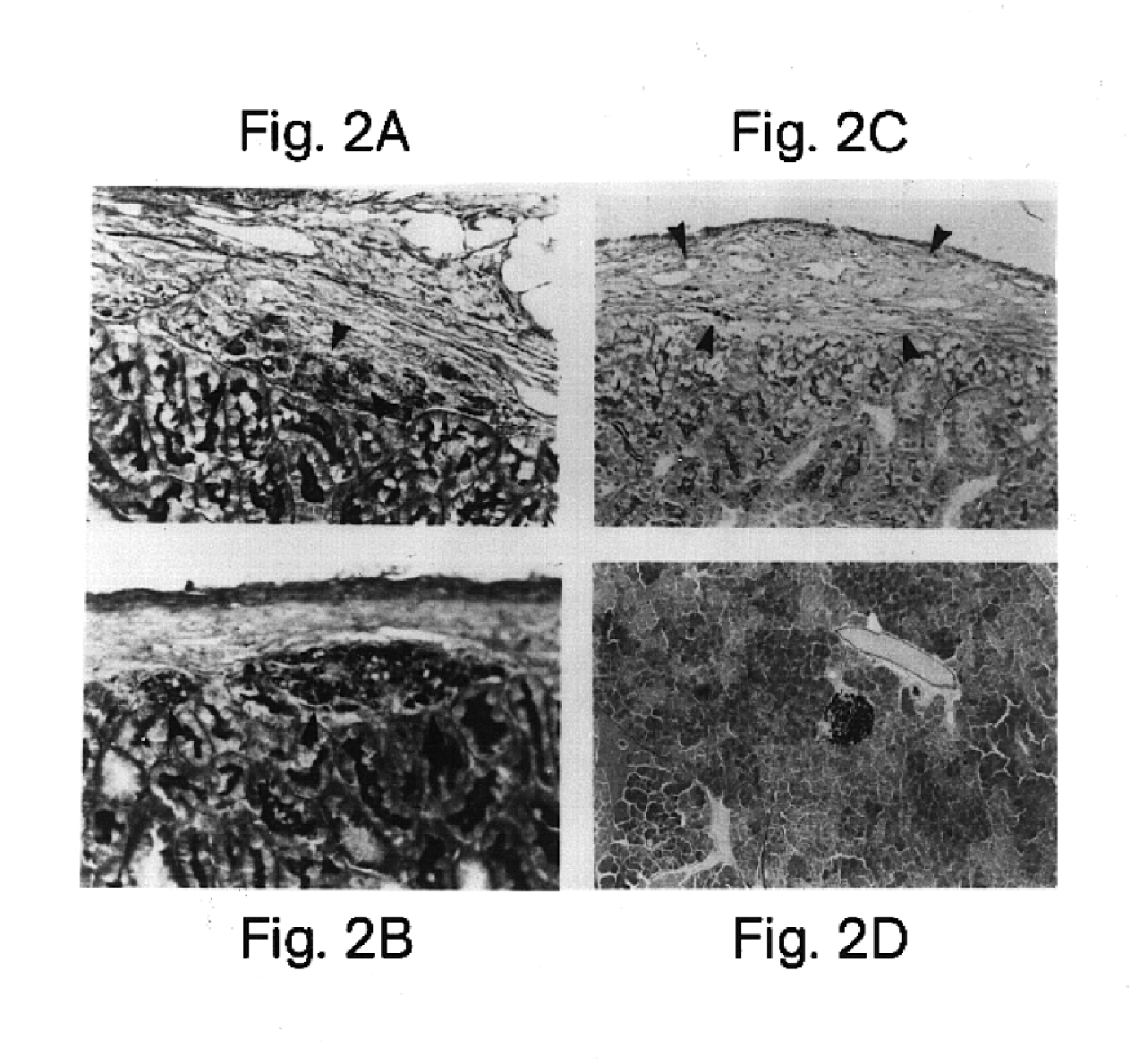 Methods for inhibiting rejection of transplanted tissue