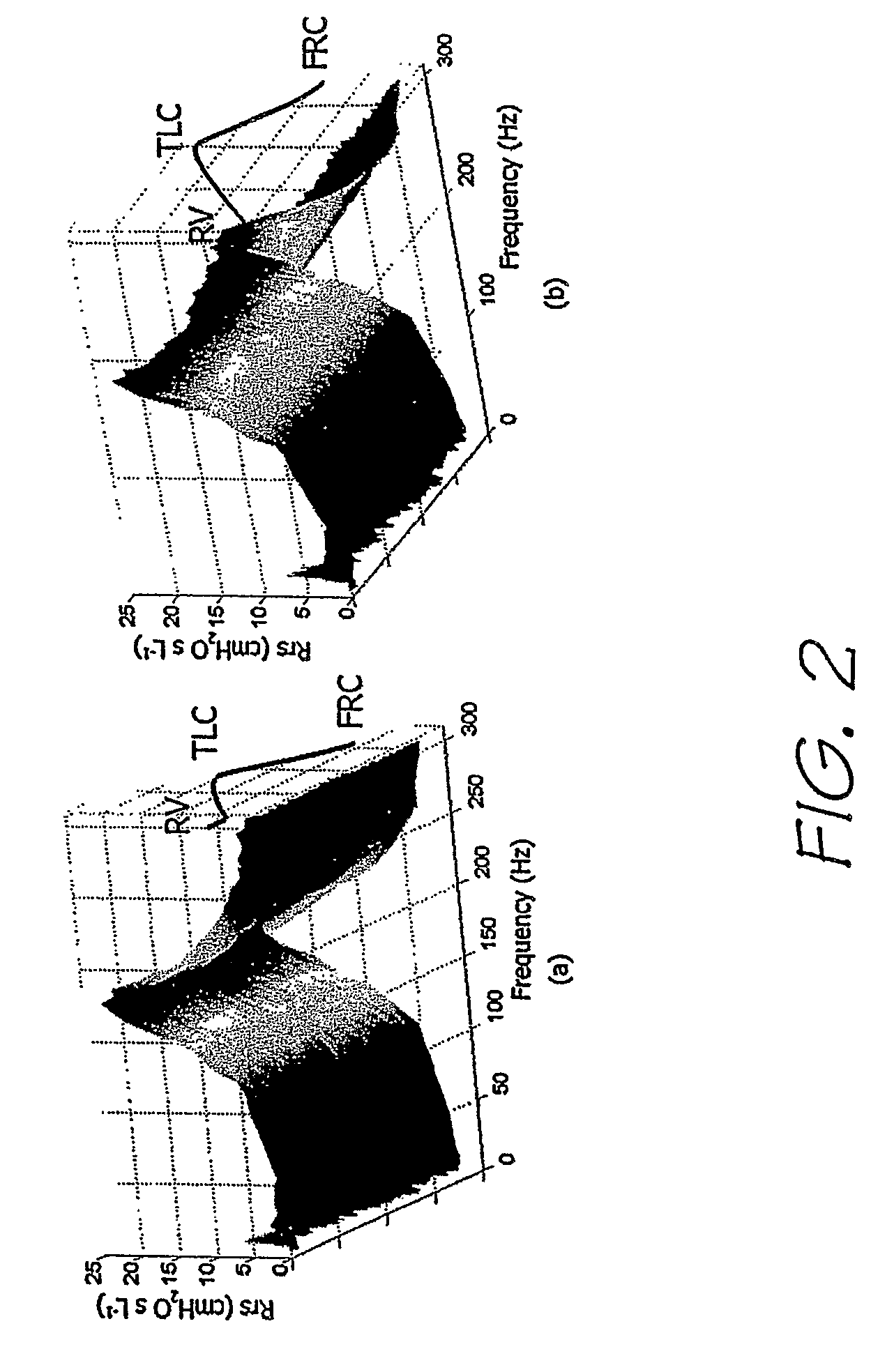 Method of measuring an acoustic impedance of a respiratory system and diagnosing a respiratory disease or disorder or monitoring treatment of same