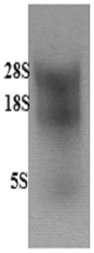 A kind of anti-carcinoembryonic antigen nanobody and its application