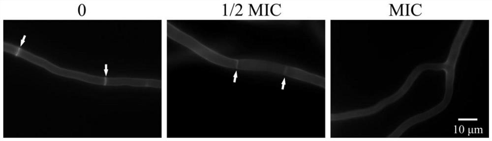 Experimental method of paeonol used as antibacterial agent against Aspergillus flavus