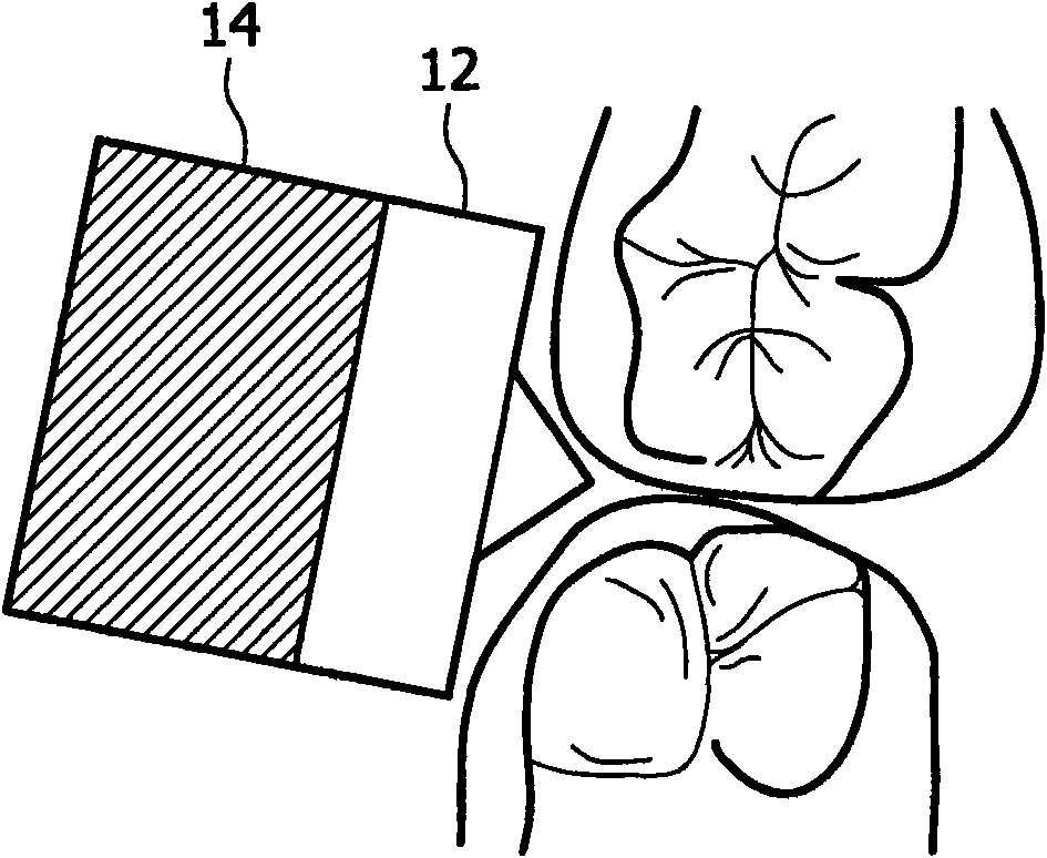 Apparatus for cleaning teeth using variable frequency ultrasound