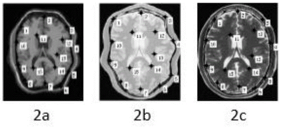 A method for precise registration of non-rigid multimodal medical images