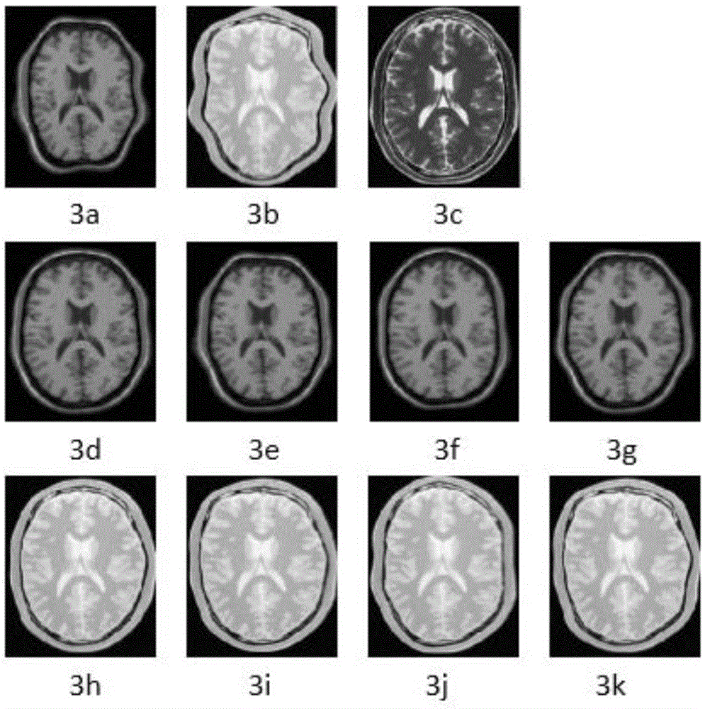 A method for precise registration of non-rigid multimodal medical images