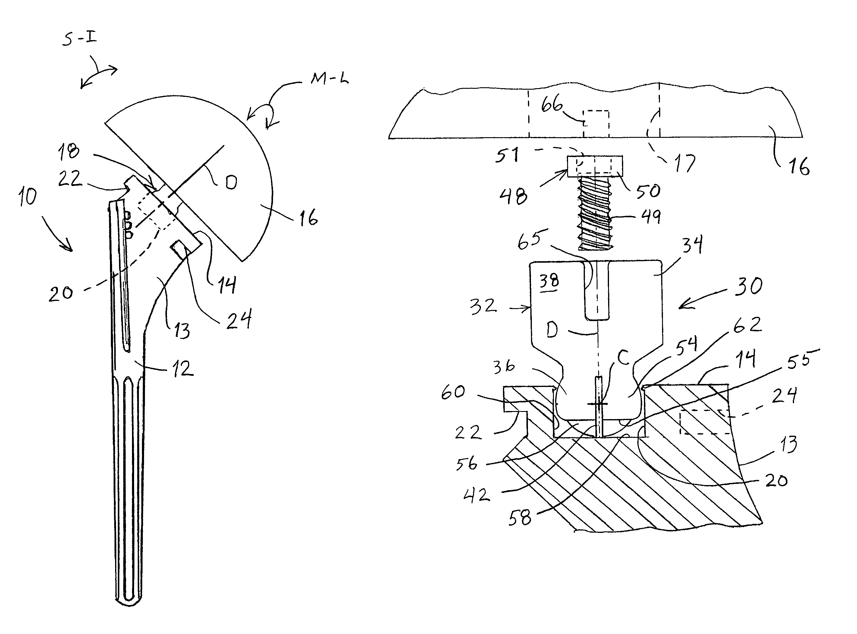 System and method for replicating orthopaedic implant orientation