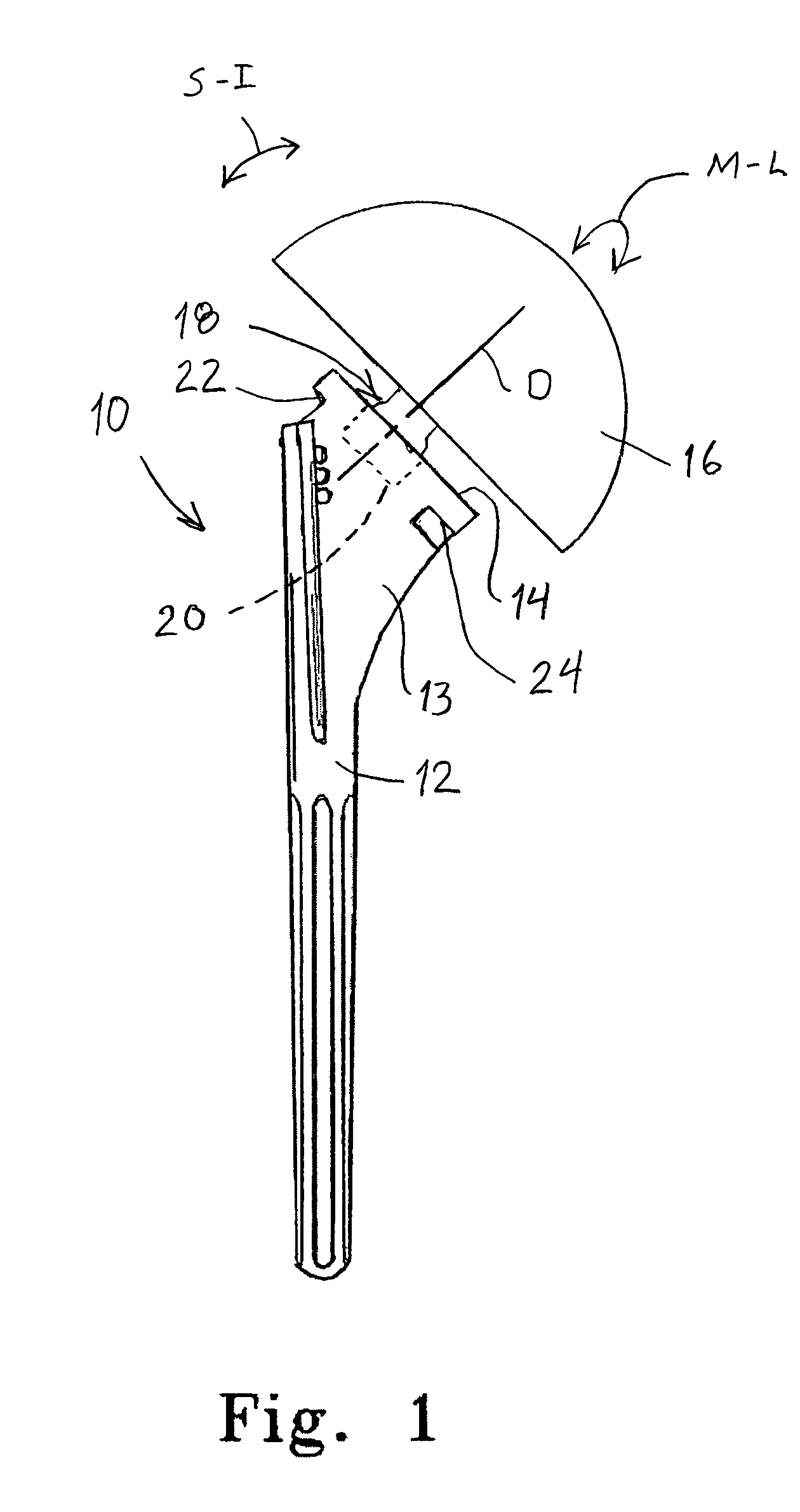 System and method for replicating orthopaedic implant orientation