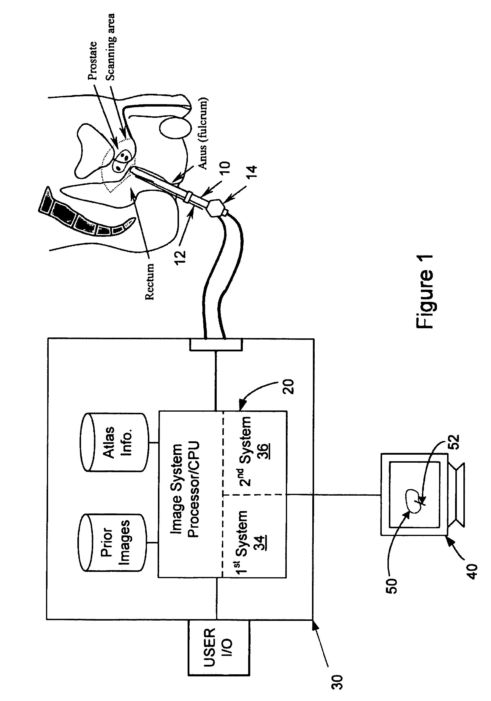 Method for tissue culture extraction