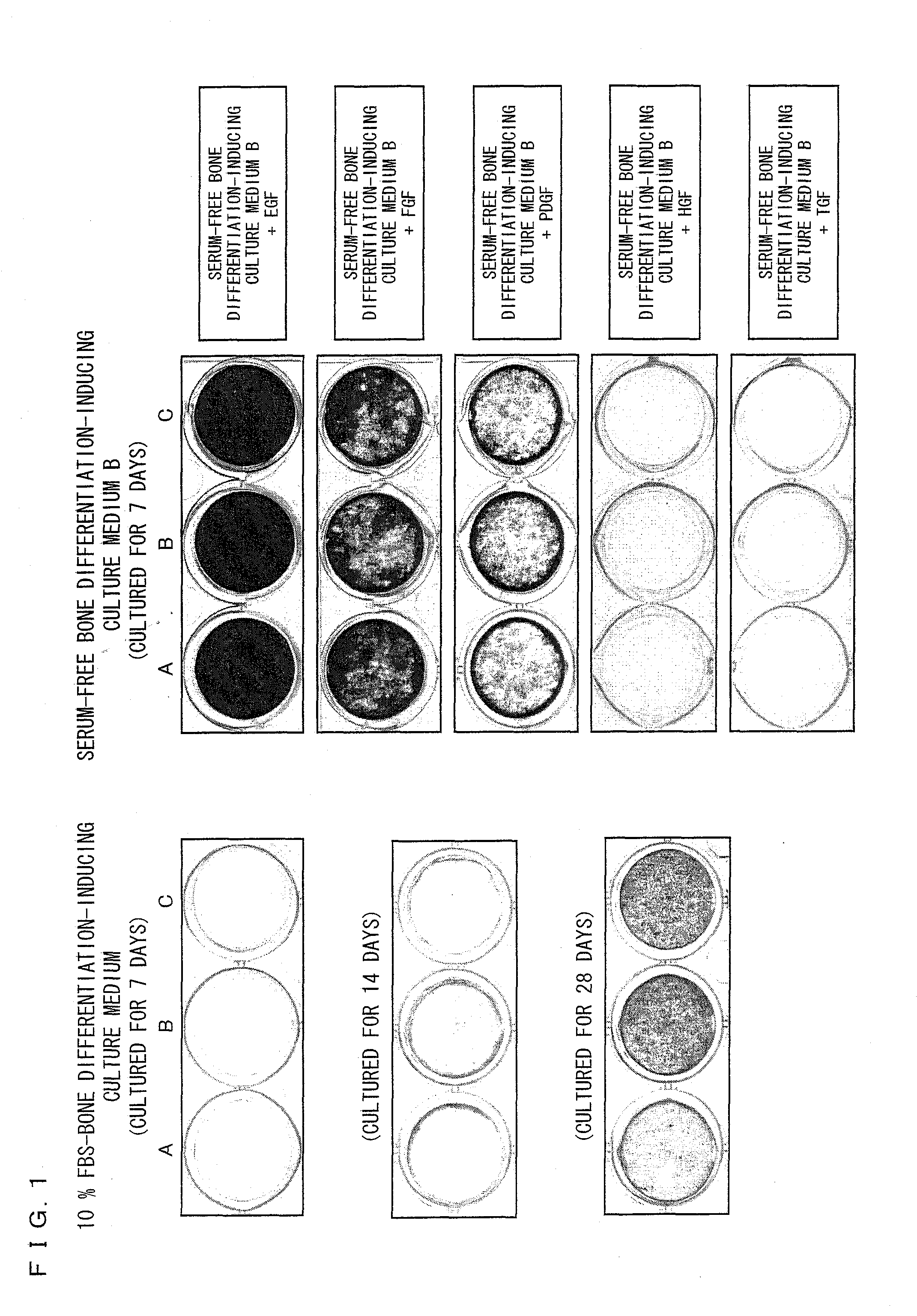 Differentiation-inducing culture medium additive and use thereof