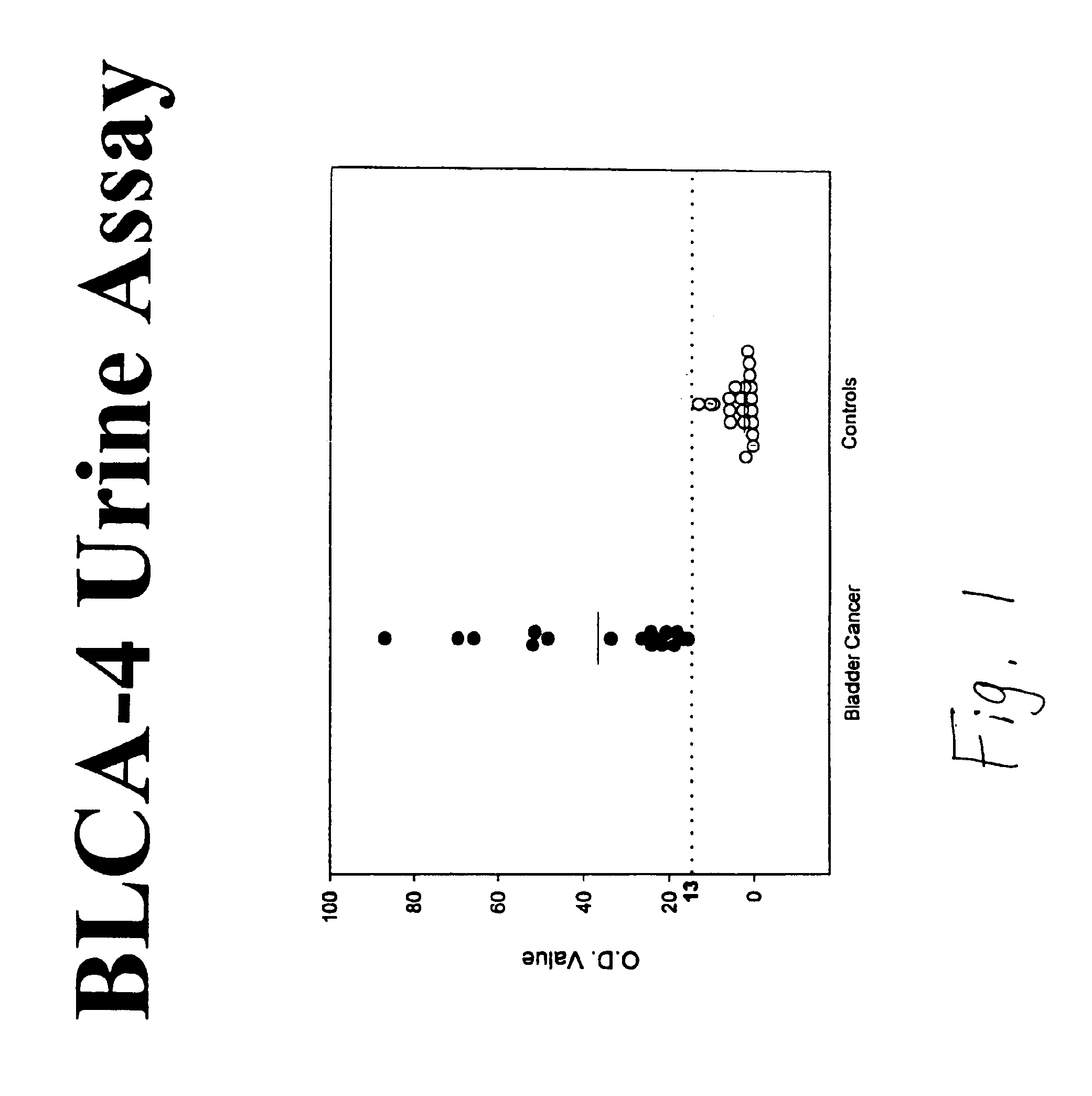 Antibody to bladder cancer nuclear matrix protein and its use