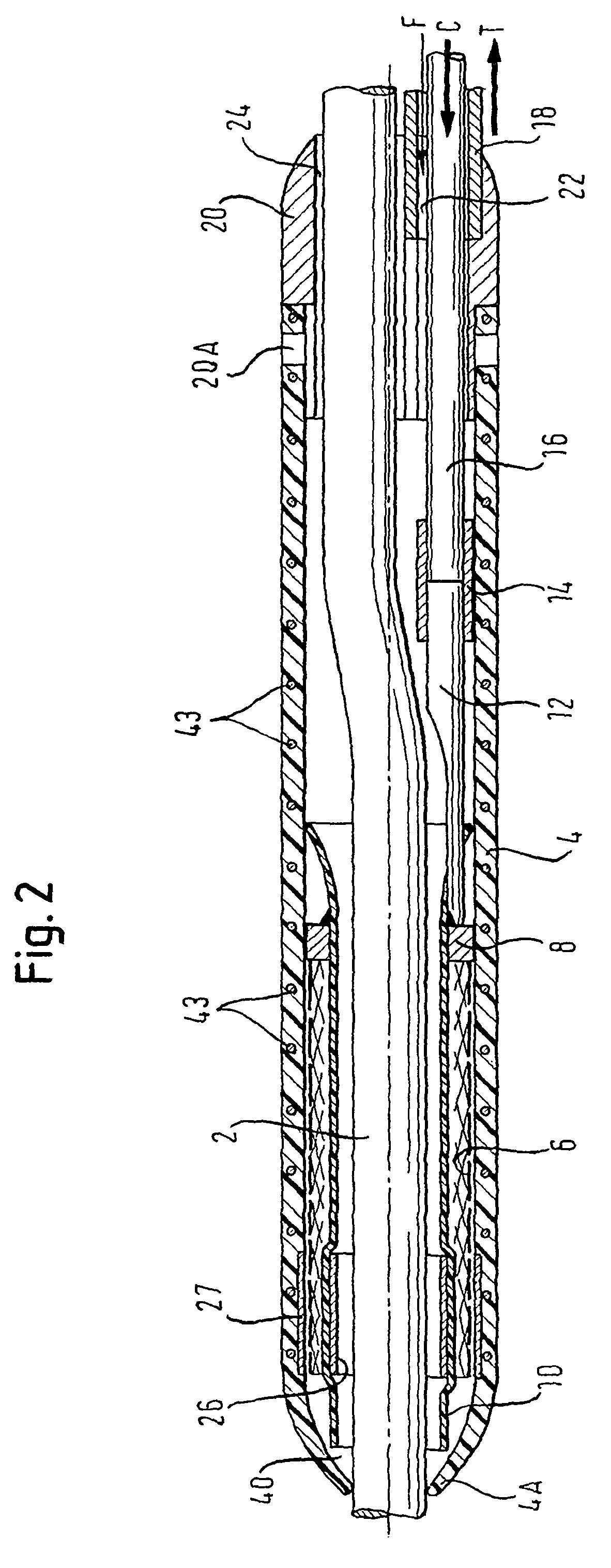 Delivery system having a rapid pusher assembly for self-expanding stent, and stent exchange configuration