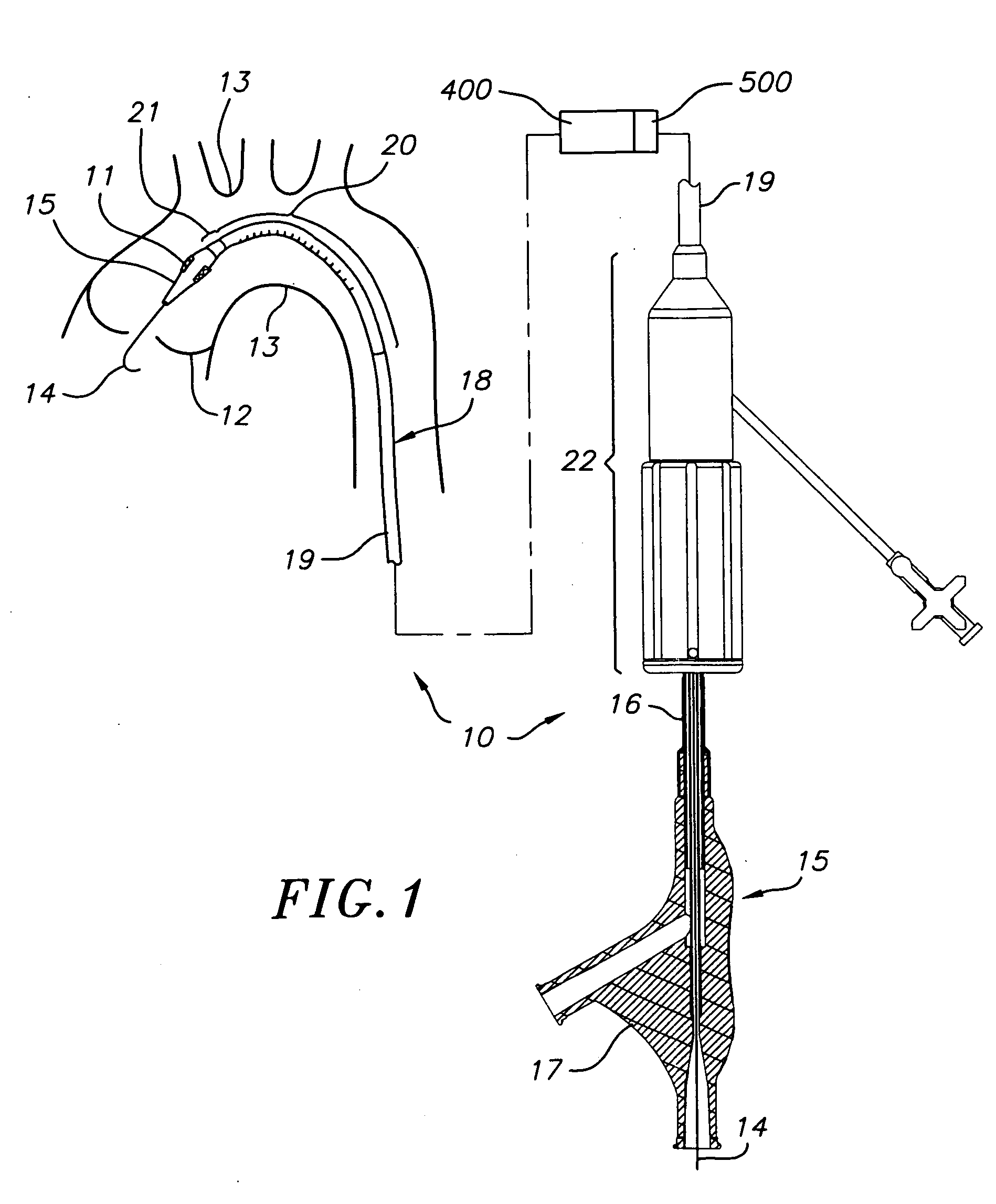 Heart valve delivery system